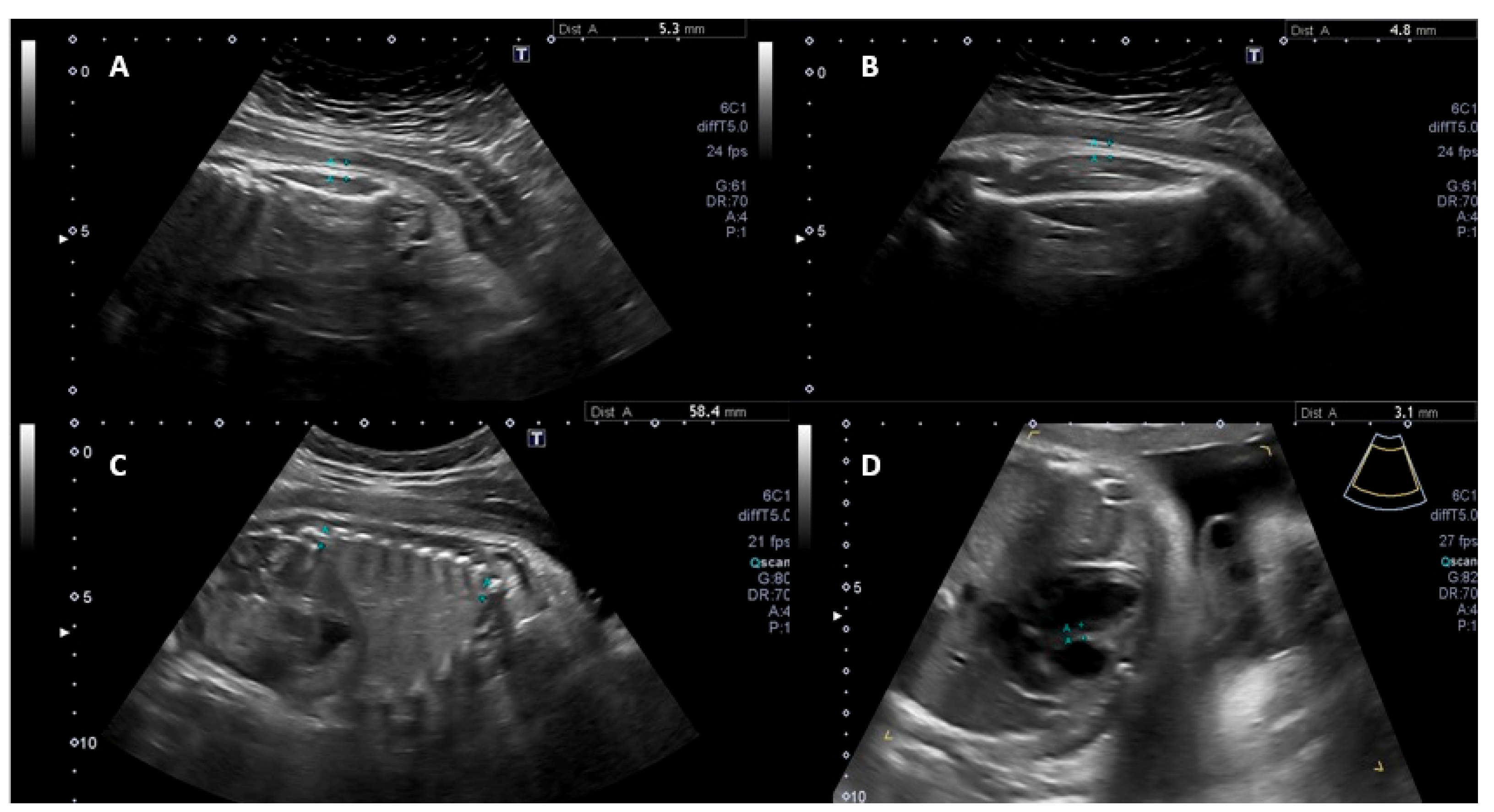 Diagnostics 15 01989 g001 Diagnostics 15 01989 g001