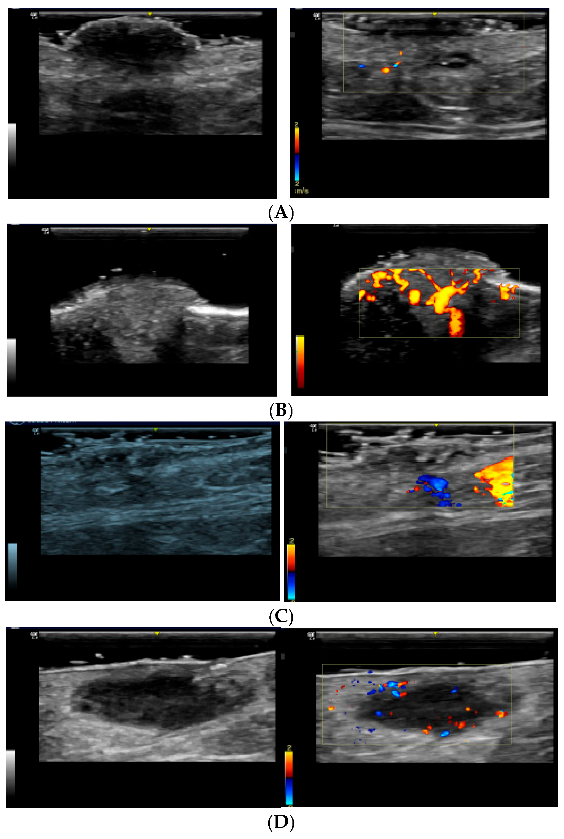 Diagnostics 15 01992 g001