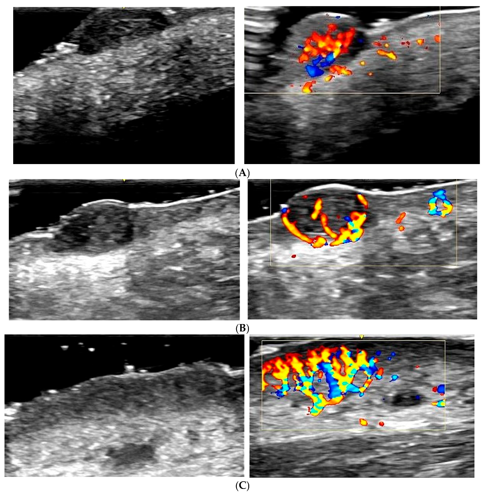 Diagnostics 15 01992 g002