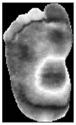 Diagnostics 15 01996 i009