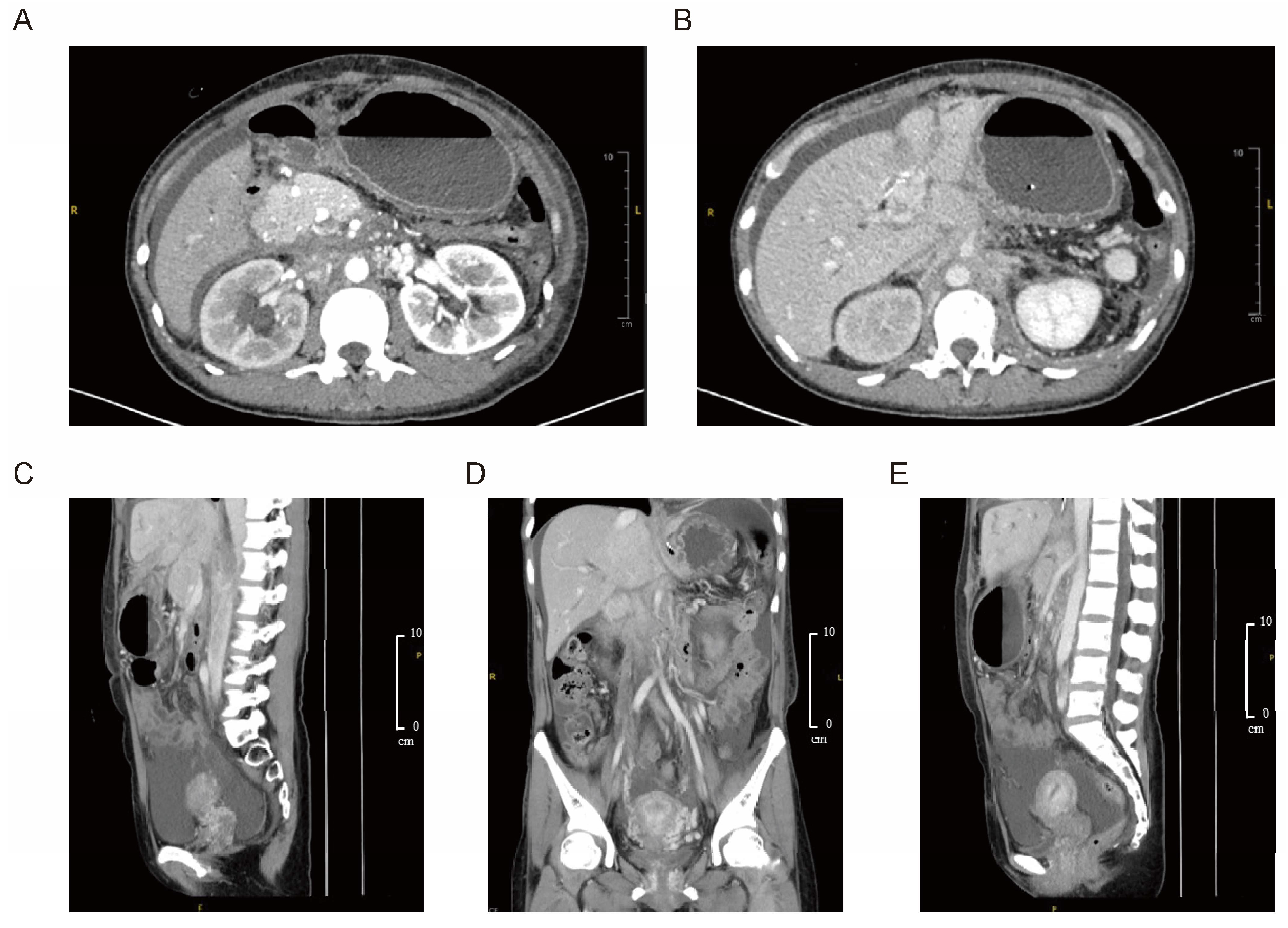 Diagnostics 15 01998 g001