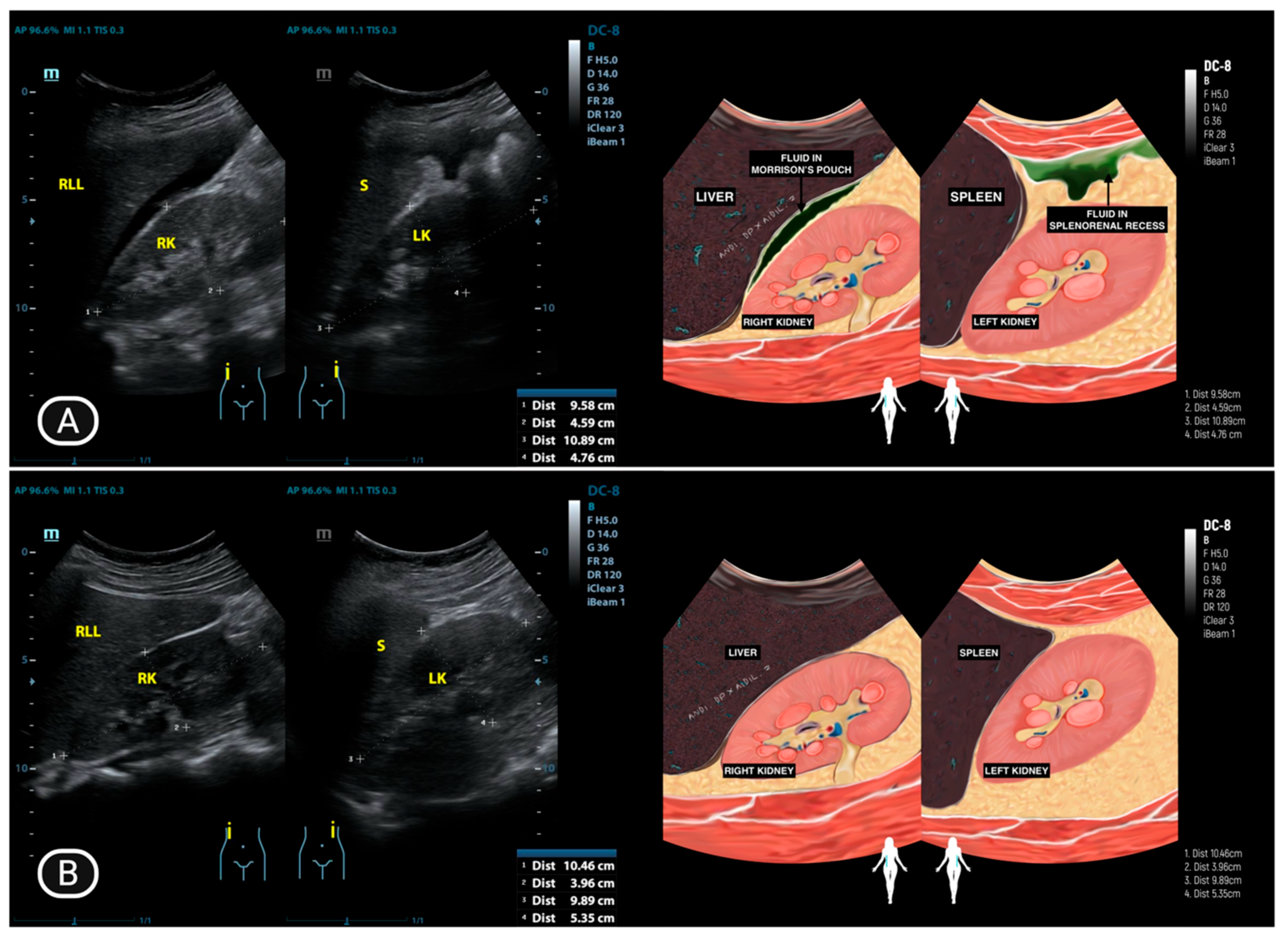 Diagnostics 15 02008 g003