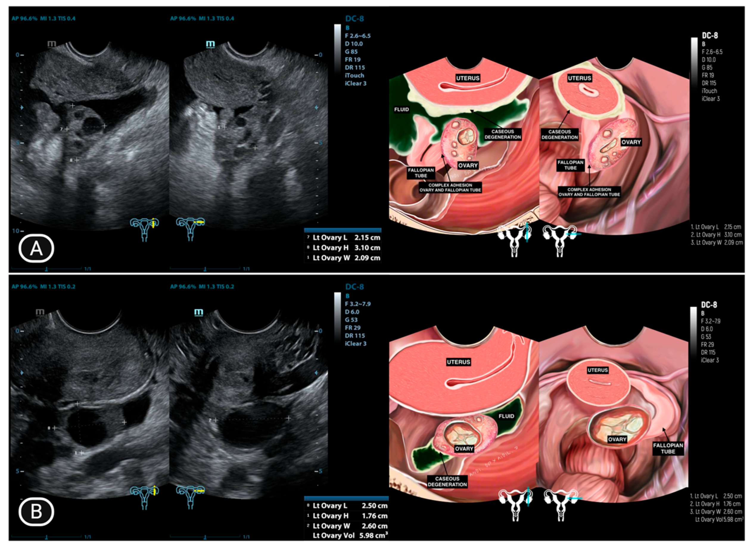 Diagnostics 15 02008 g005