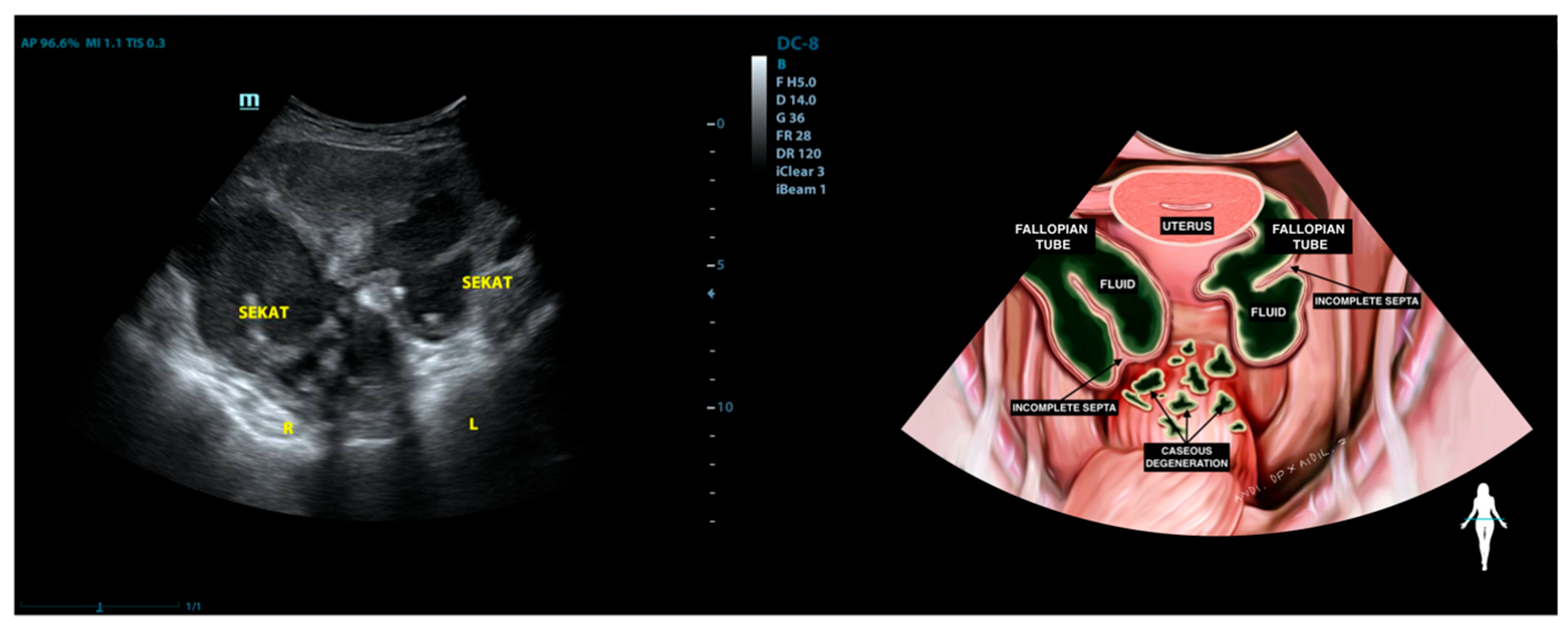 Diagnostics 15 02008 g006