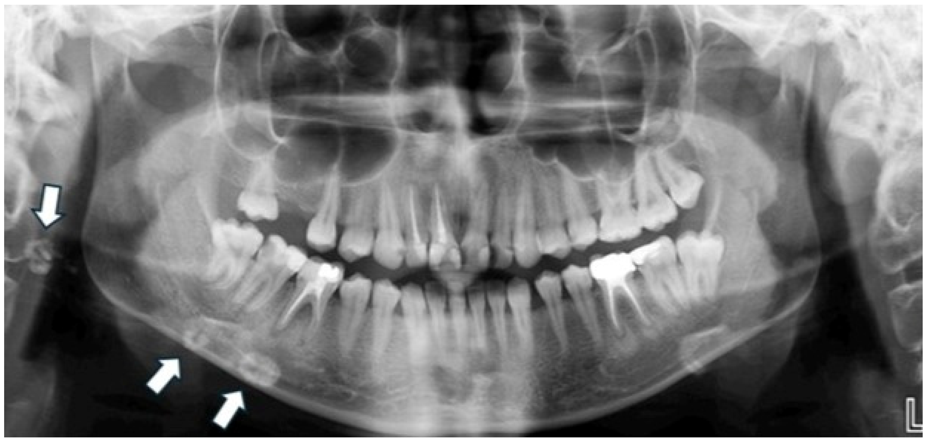 Diagnostics 15 02013 g004
