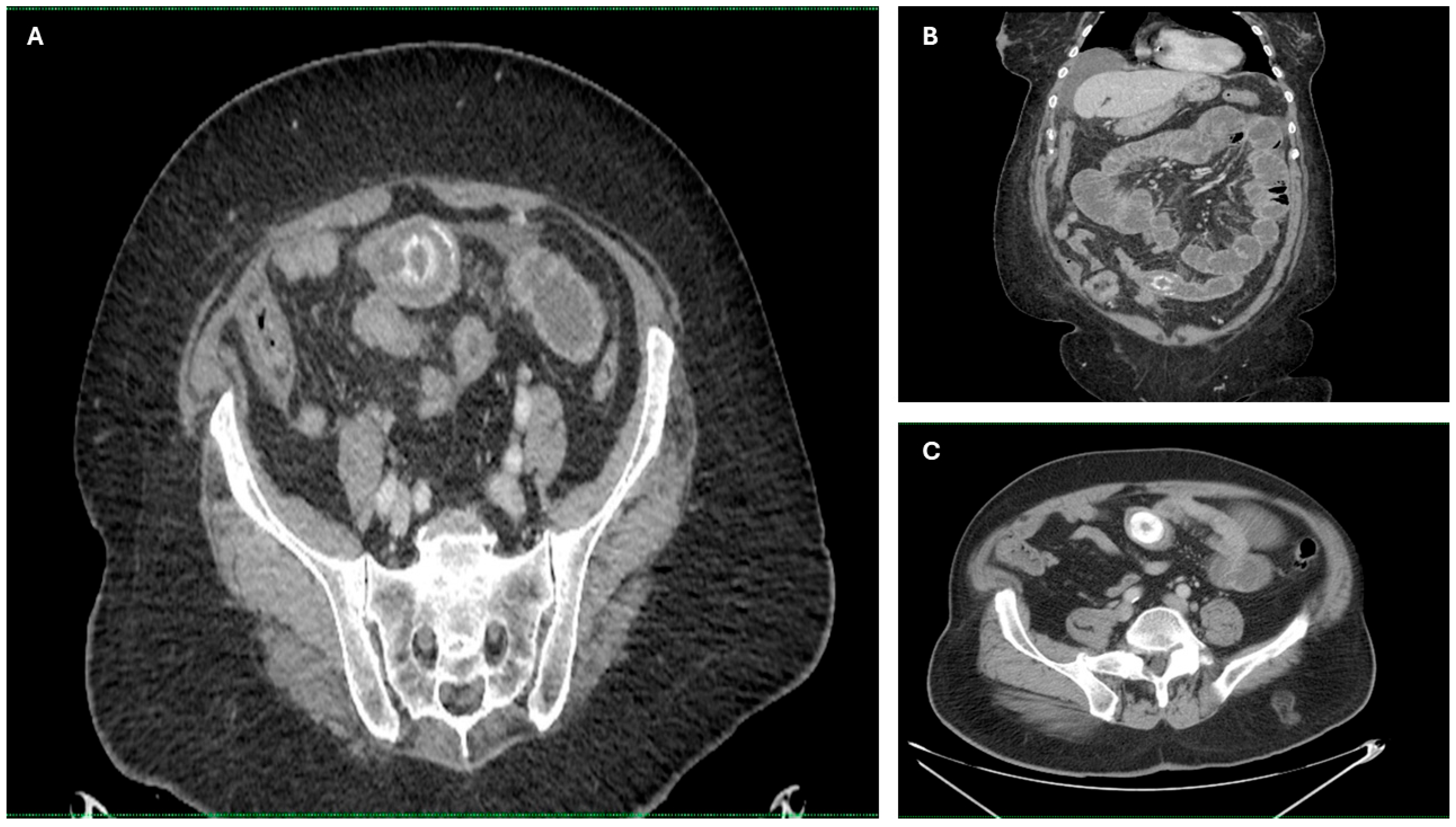 Diagnostics 15 02017 g003