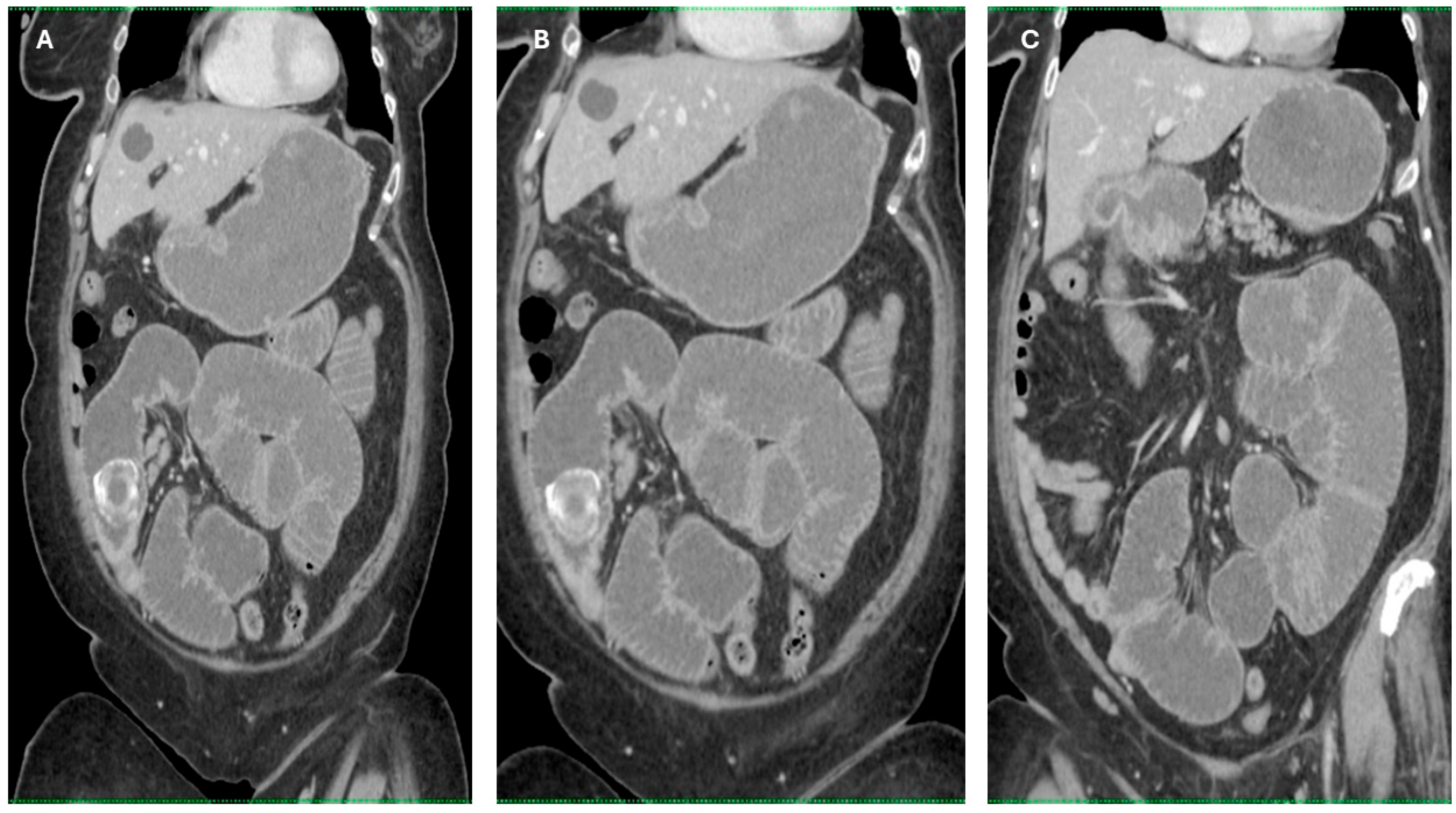 Diagnostics 15 02017 g004