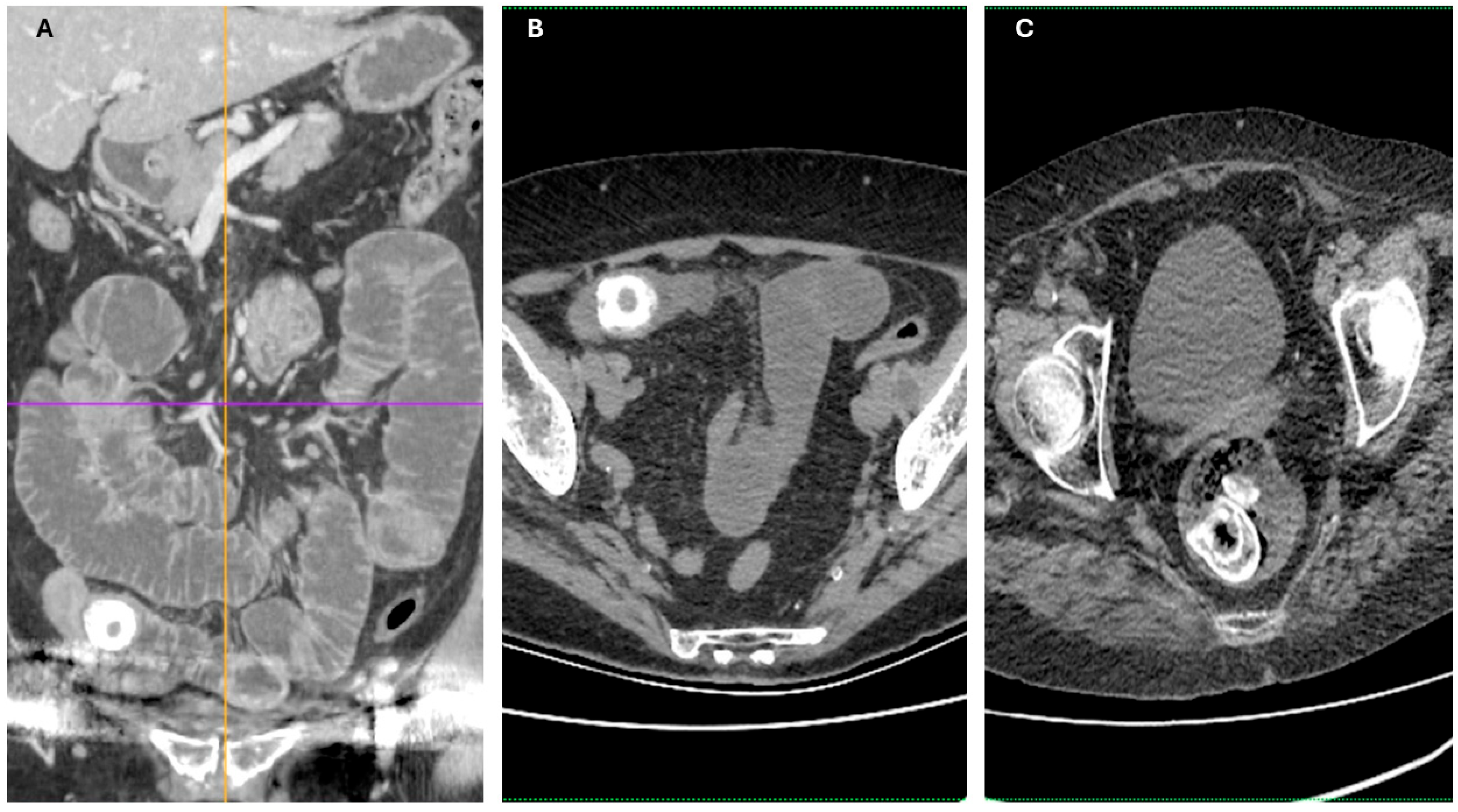 Diagnostics 15 02017 g005