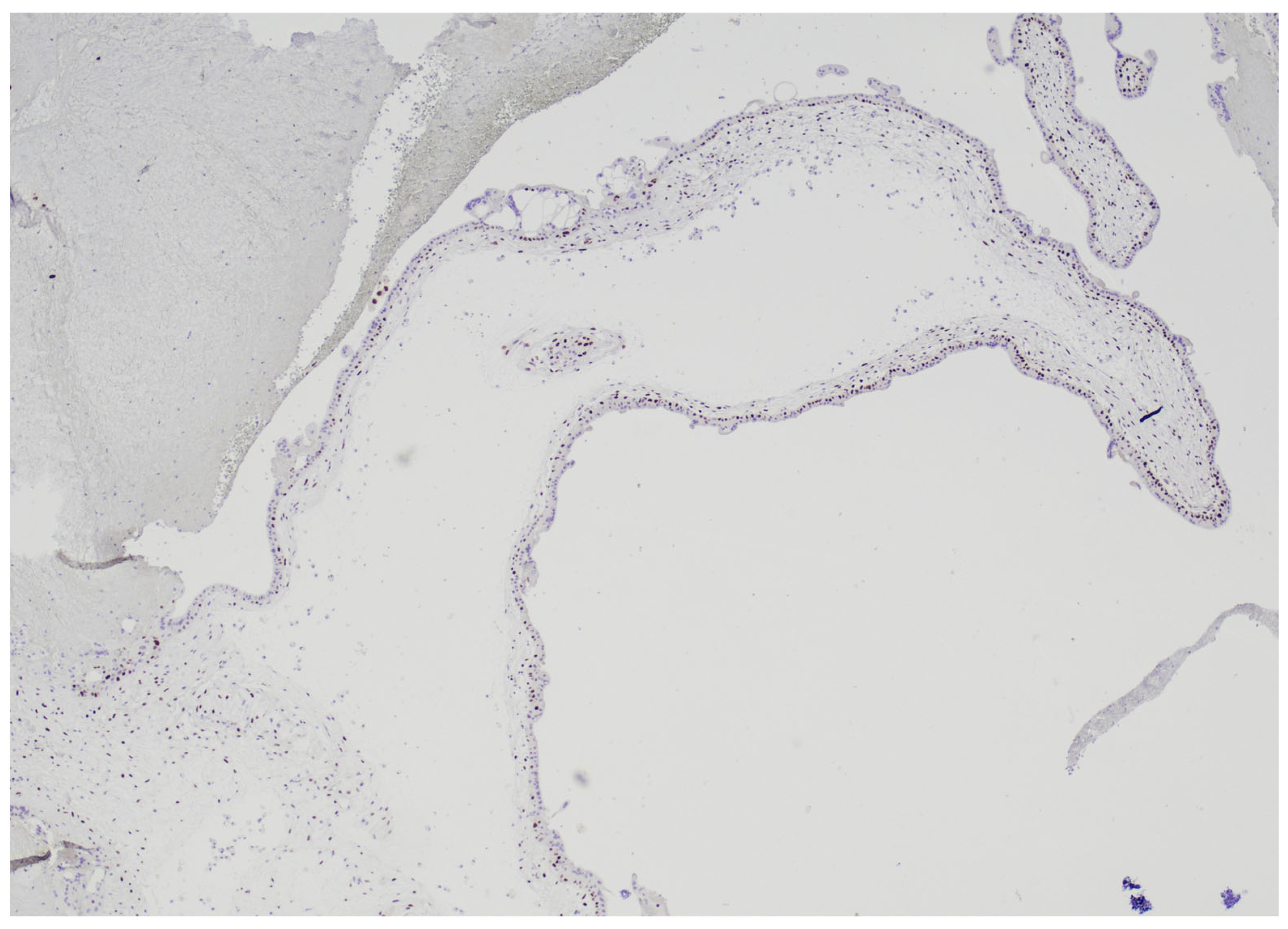 Diagnostics 15 02024 g004 Diagnostics 15 02024 g004