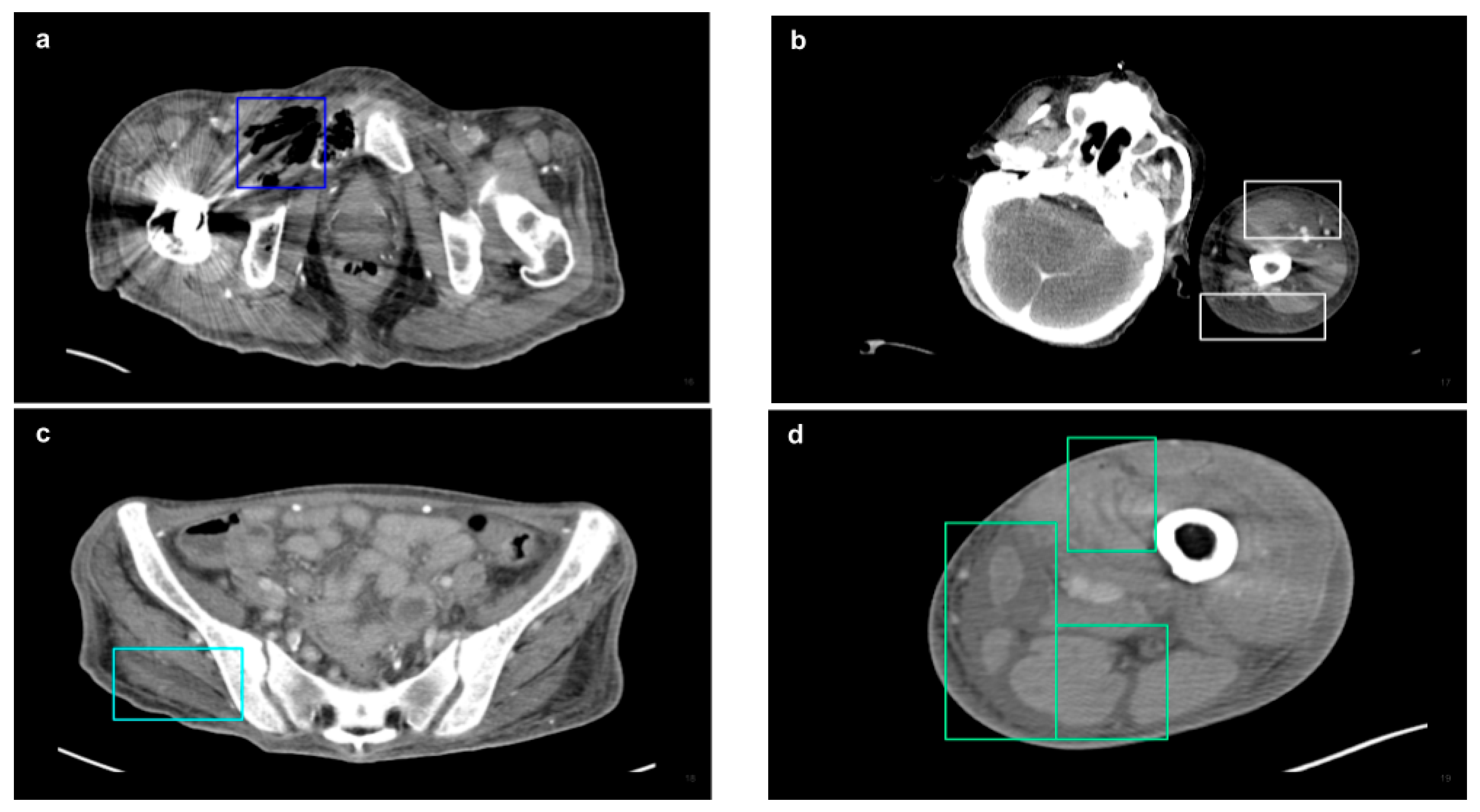 Diagnostics 15 02030 g003 Diagnostics 15 02030 g003
