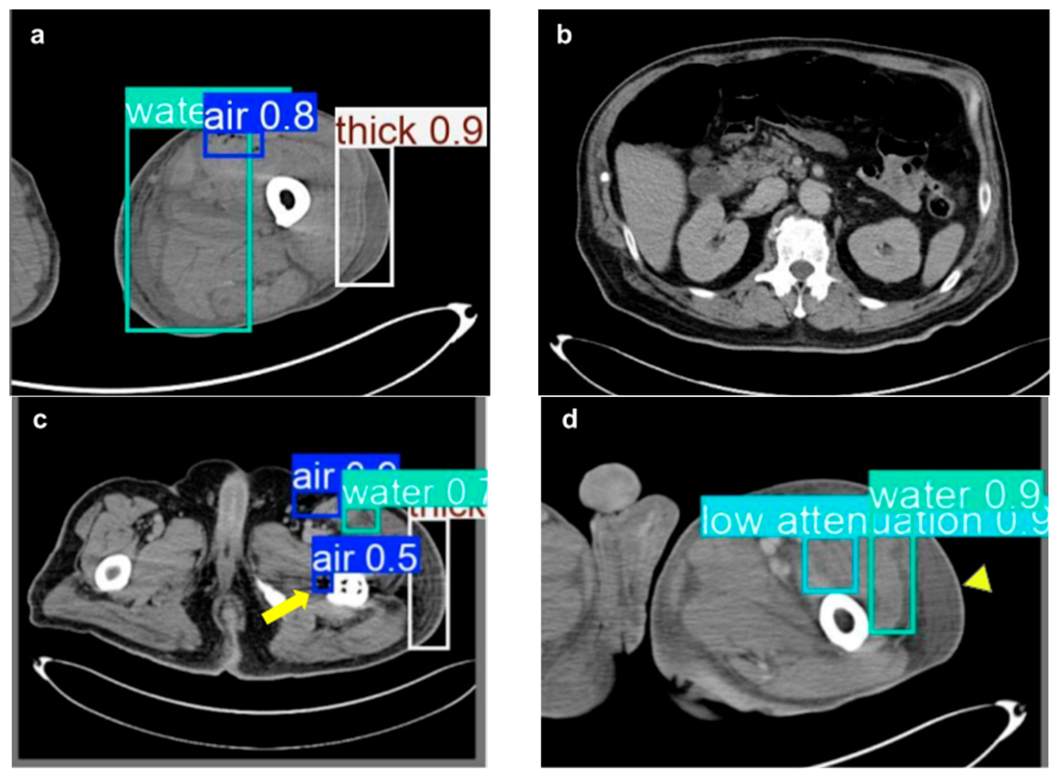Diagnostics 15 02030 g007 Diagnostics 15 02030 g007