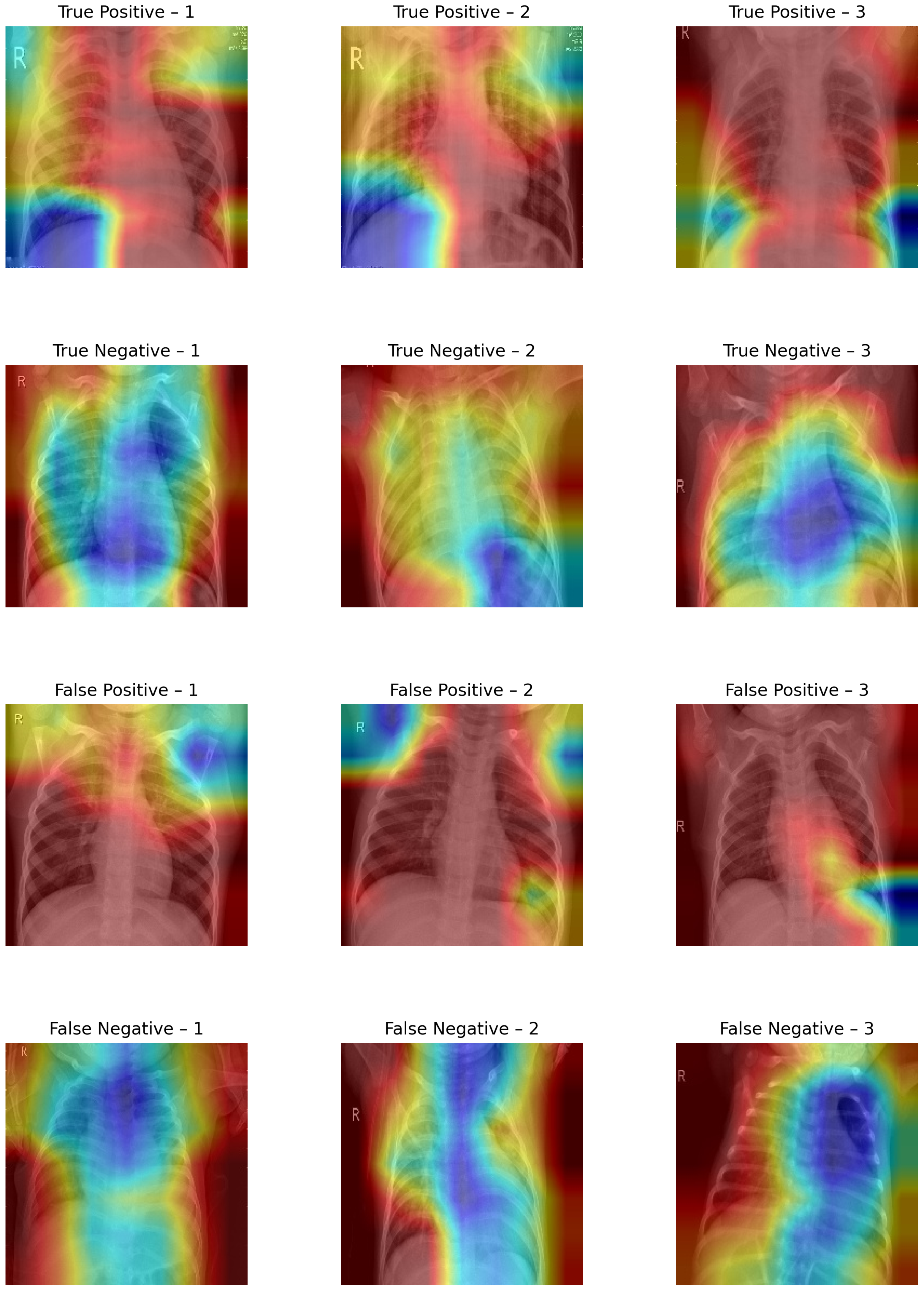 Diagnostics 15 02041 g008