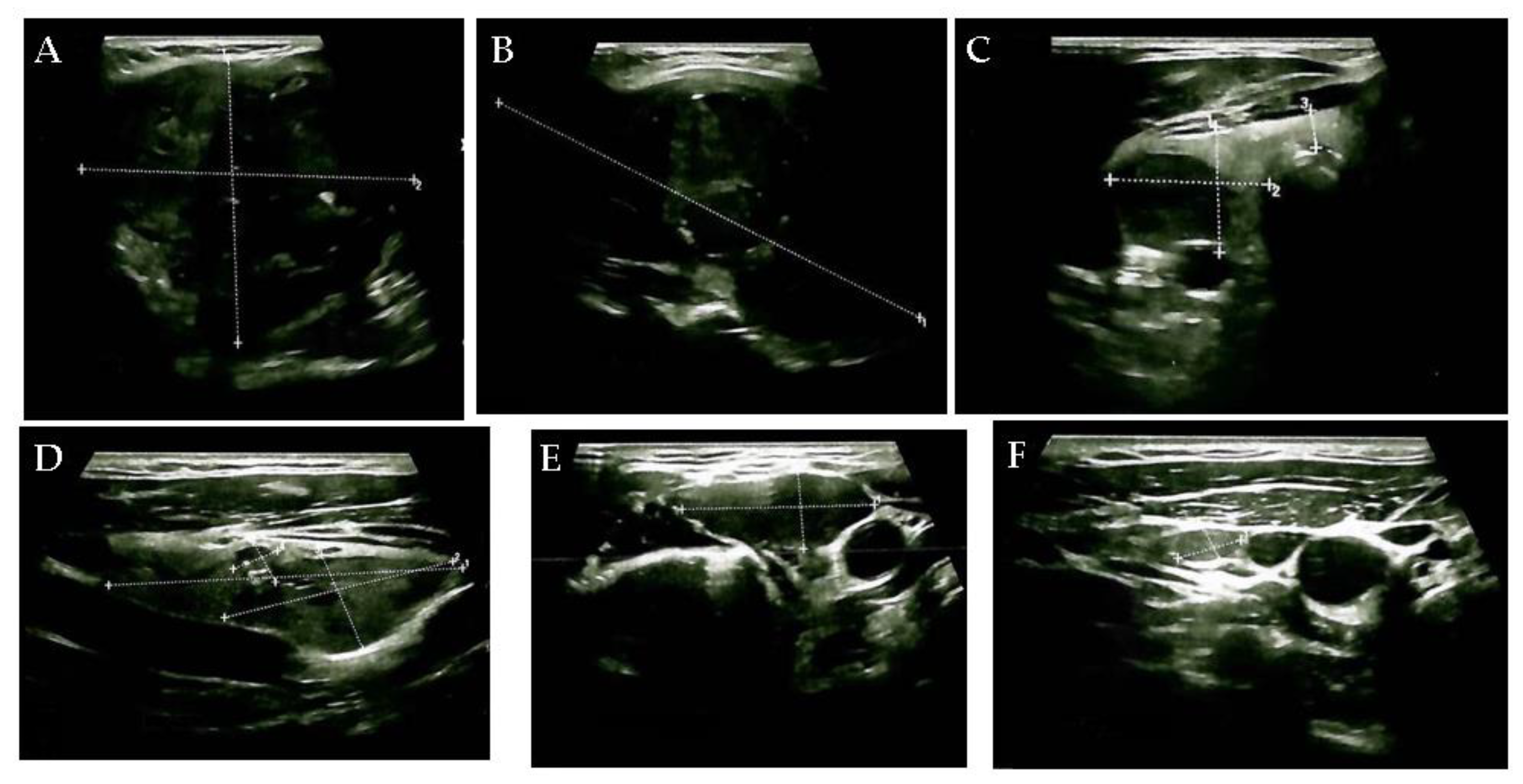 Diagnostics 15 02049 g001 Diagnostics 15 02049 g001
