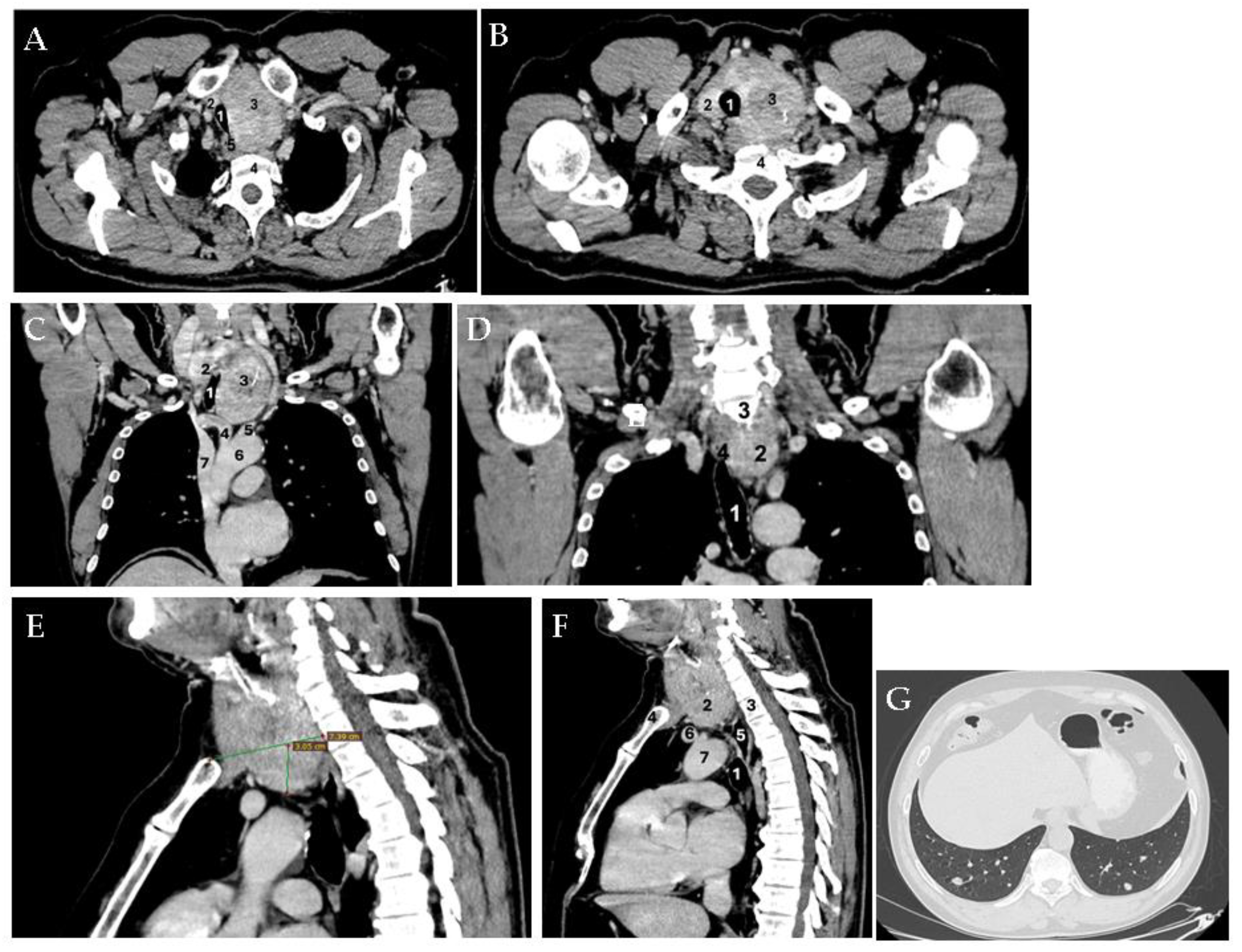 Diagnostics 15 02049 g002 Diagnostics 15 02049 g002