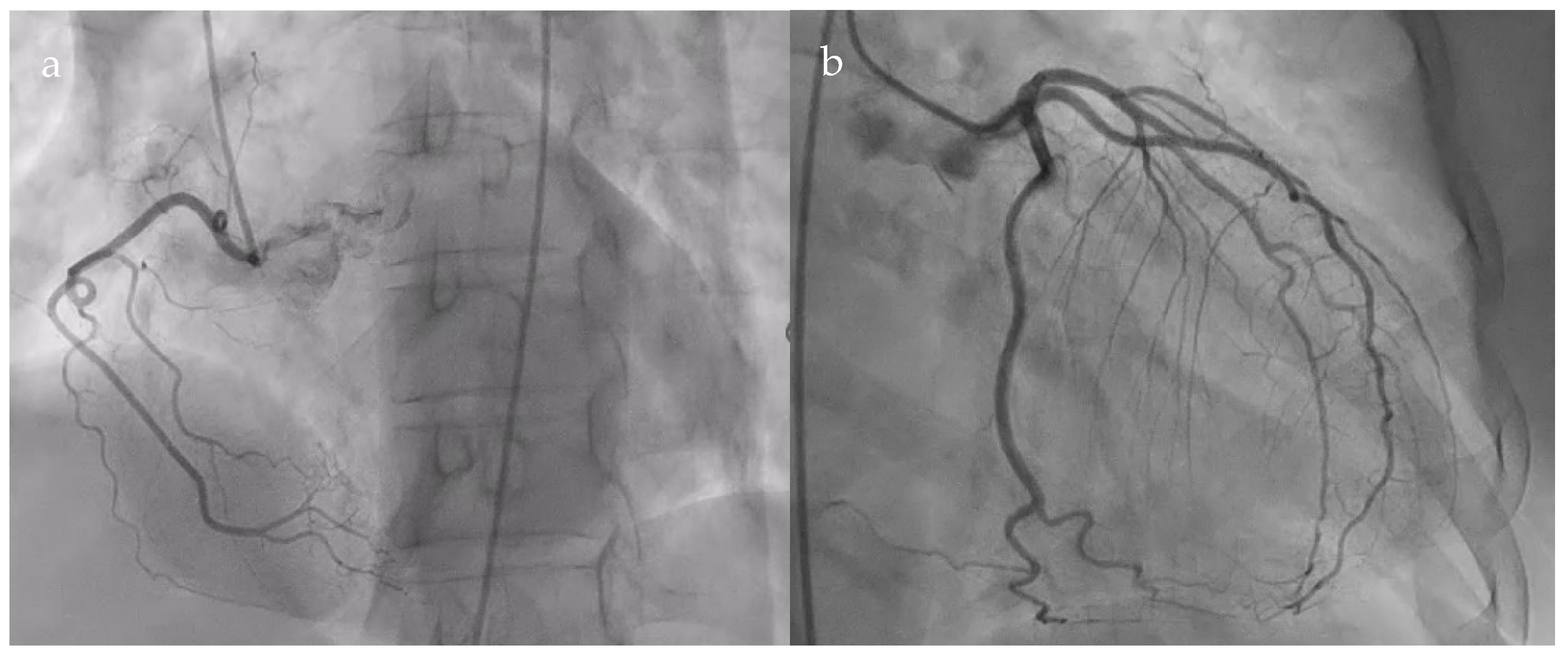 Diagnostics 15 02058 g002 Diagnostics 15 02058 g002