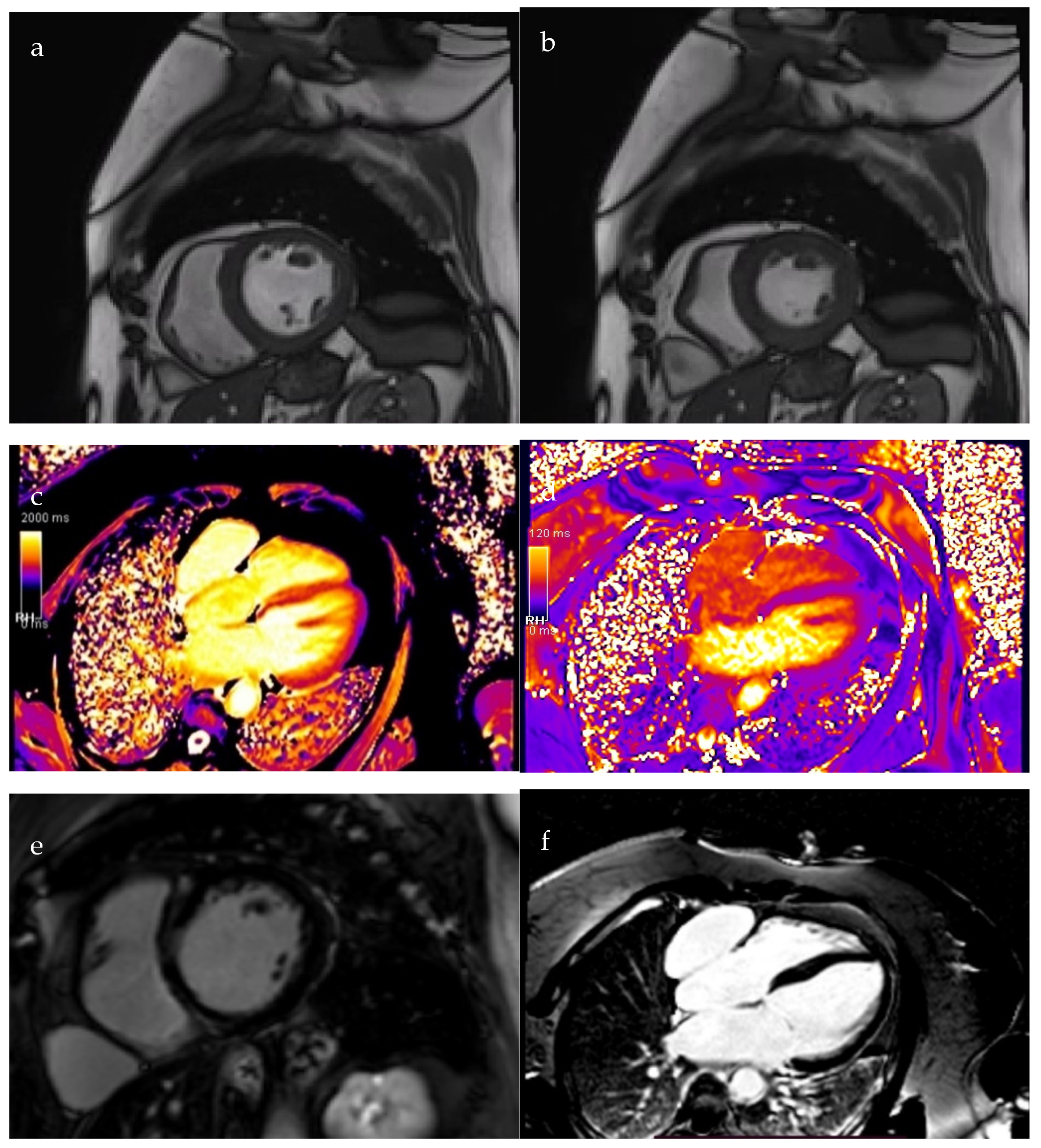 Diagnostics 15 02058 g003a Diagnostics 15 02058 g003a