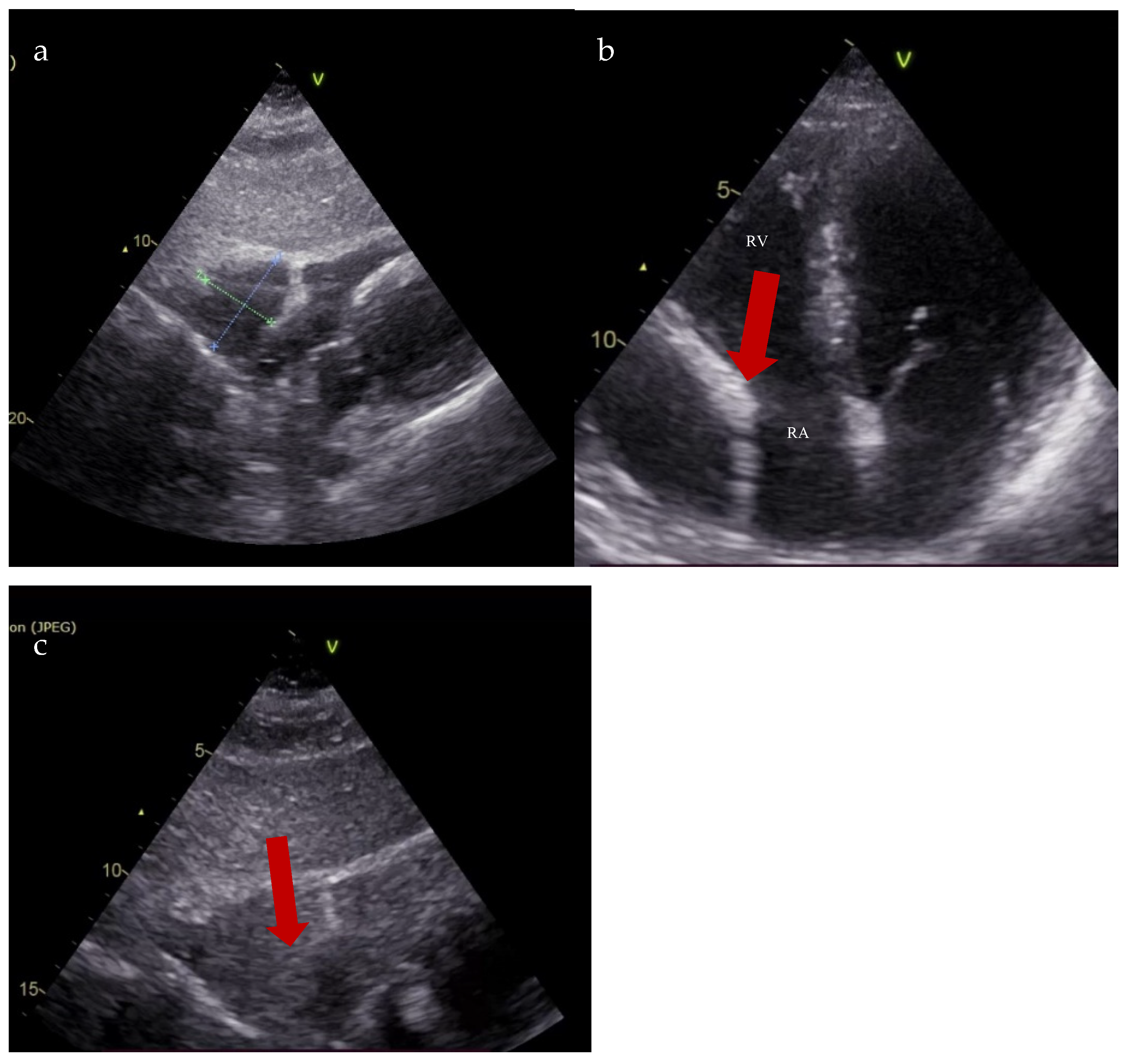 Diagnostics 15 02058 g004 Diagnostics 15 02058 g004