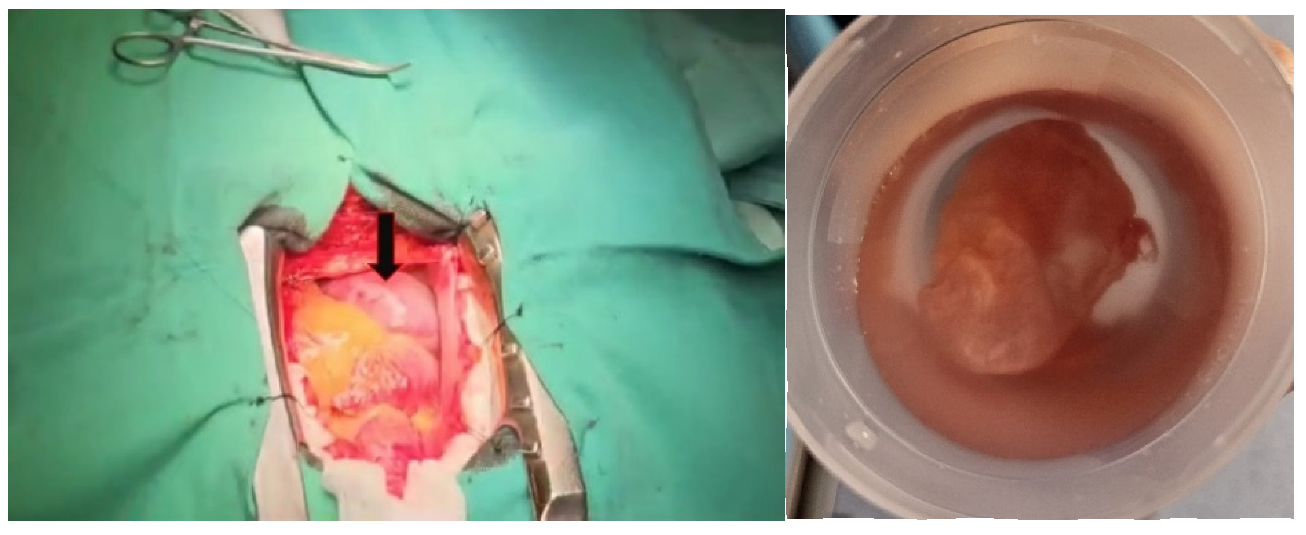 Diagnostics 15 02058 g005 Diagnostics 15 02058 g005