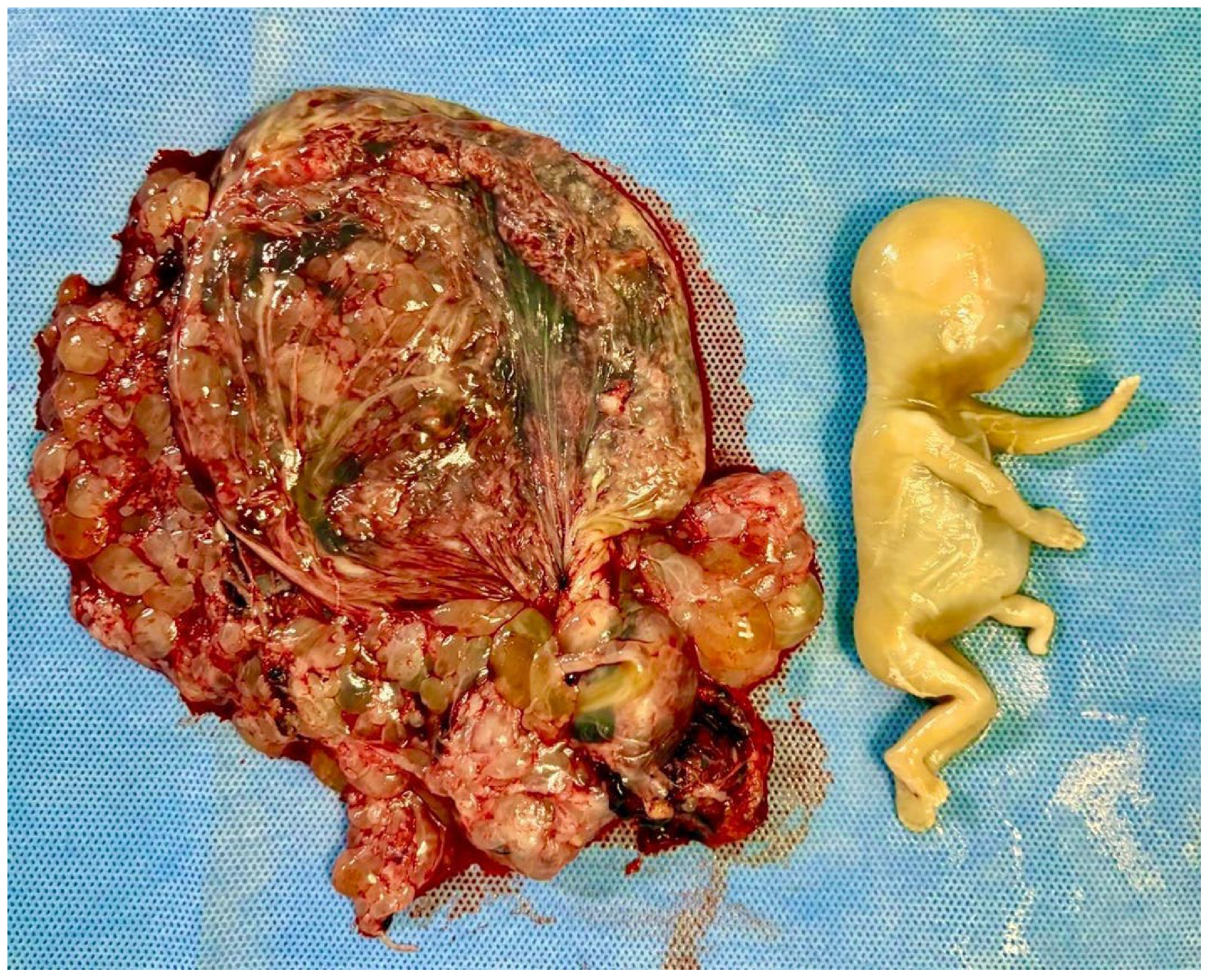 Diagnostics 15 02068 g002 Diagnostics 15 02068 g002