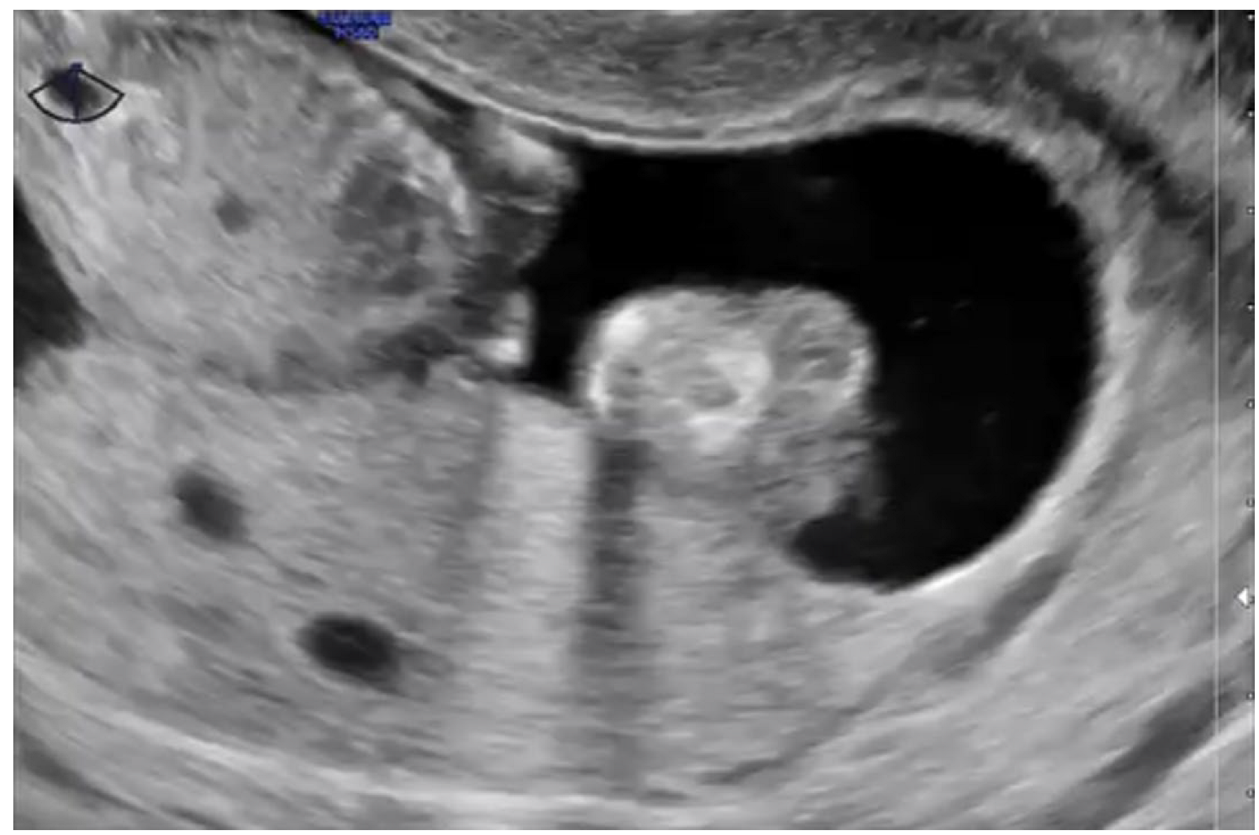 Diagnostics 15 02068 g004 Diagnostics 15 02068 g004