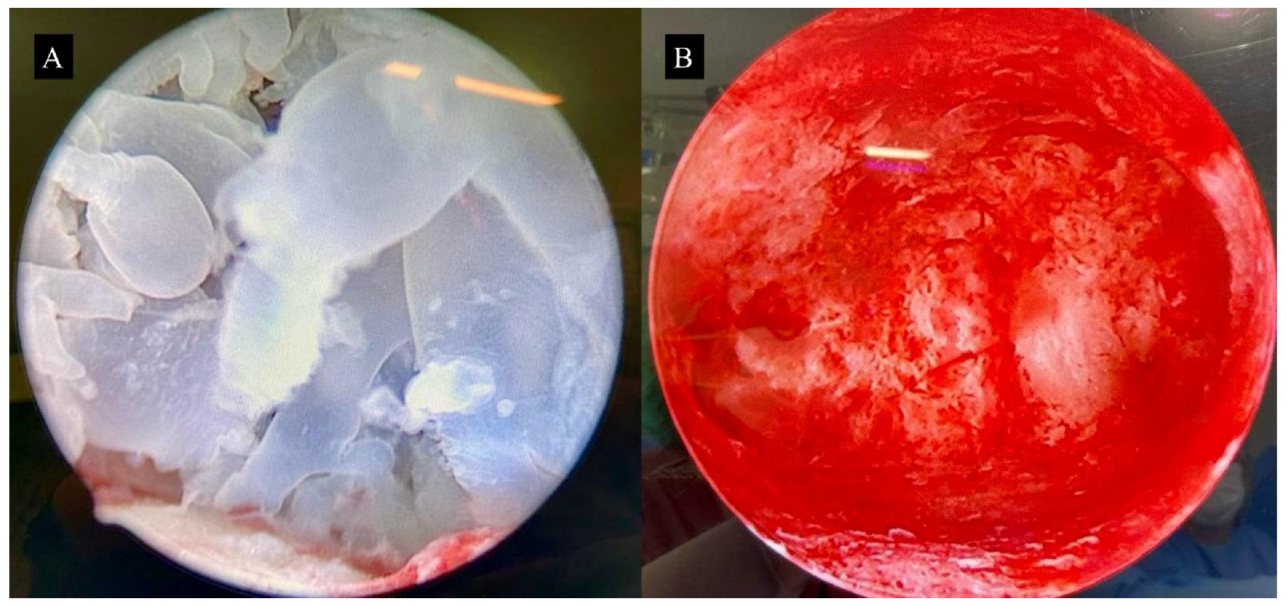 Diagnostics 15 02068 g006 Diagnostics 15 02068 g006