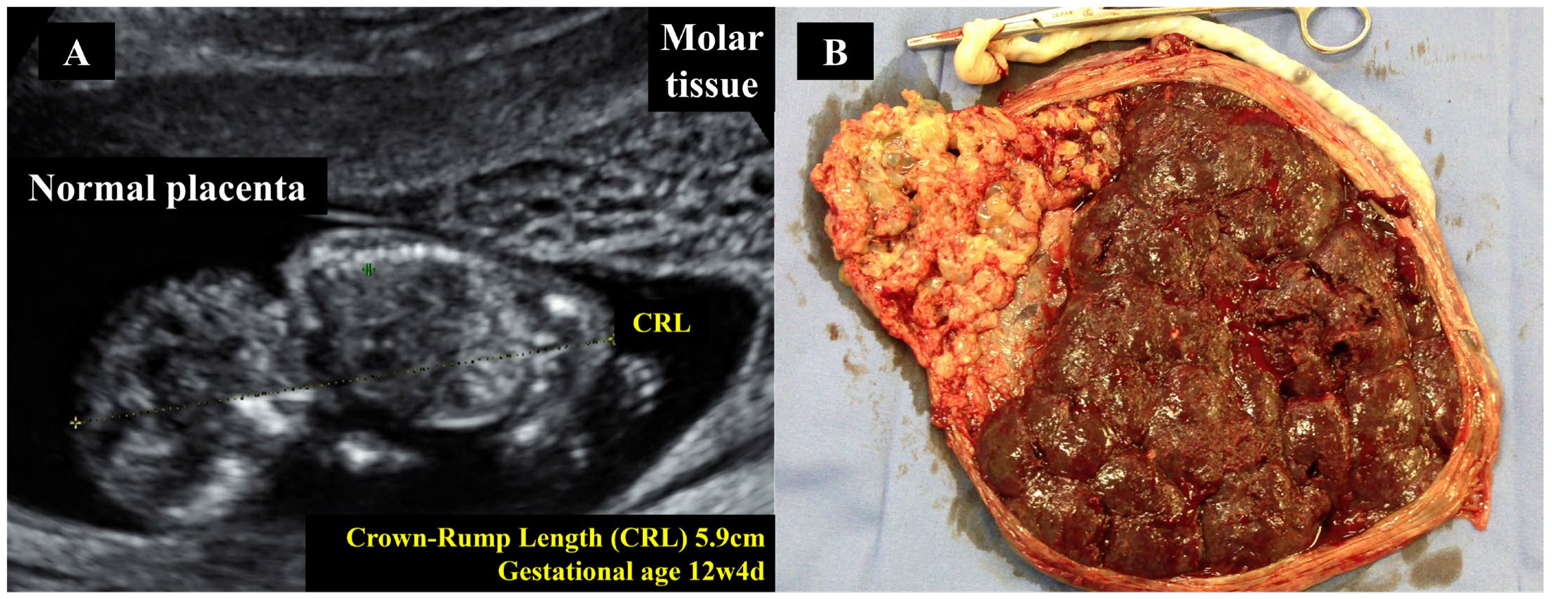 Diagnostics 15 02068 g009 Diagnostics 15 02068 g009