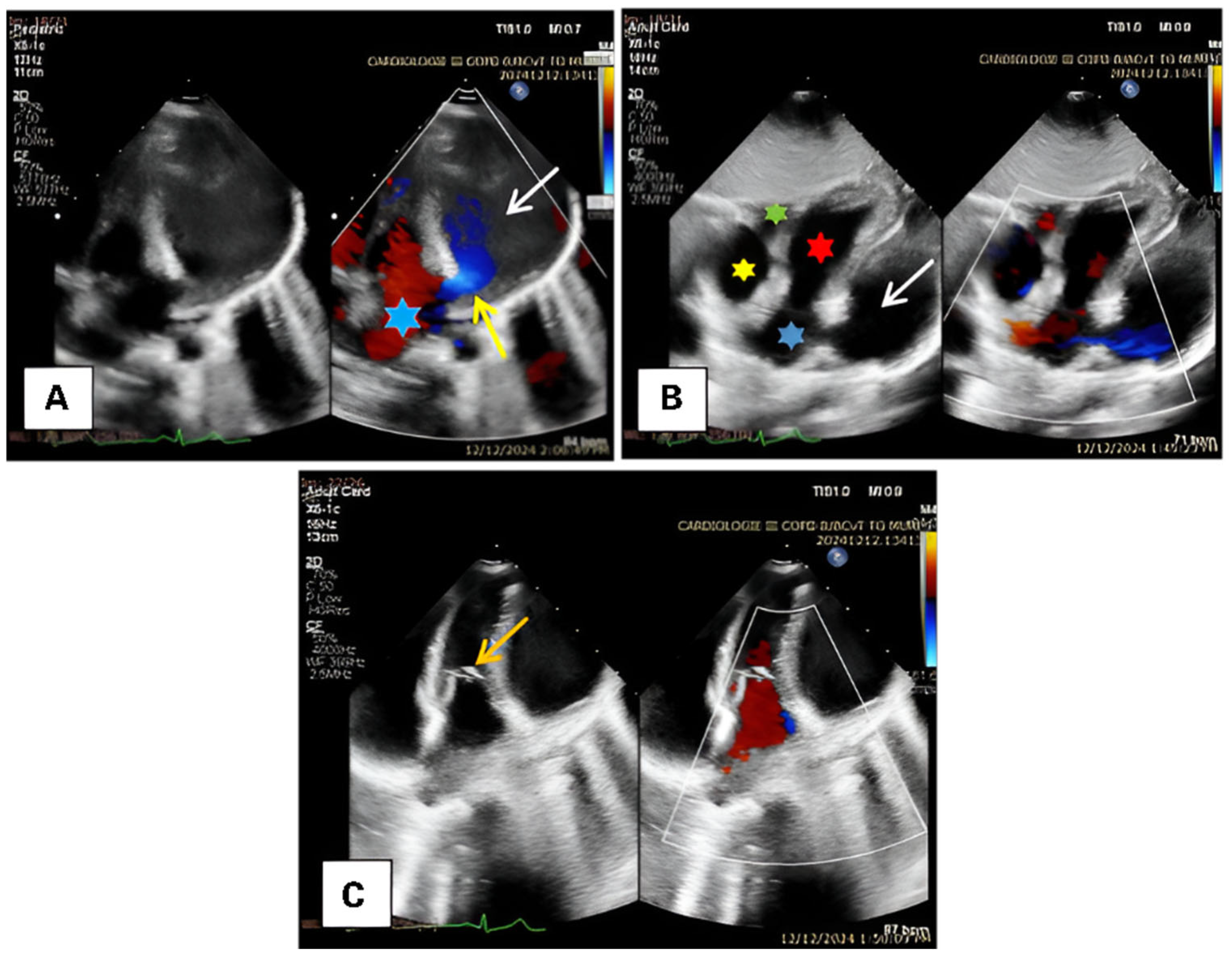 Diagnostics 15 02070 g002 Diagnostics 15 02070 g002