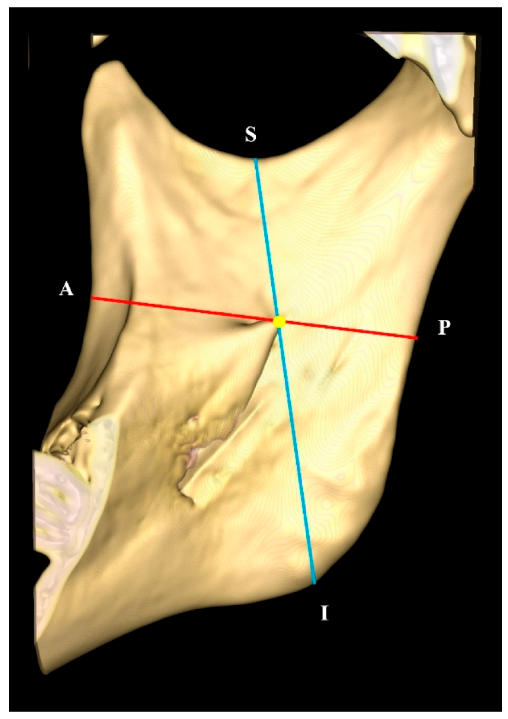 Diagnostics 15 02071 g003 Diagnostics 15 02071 g003