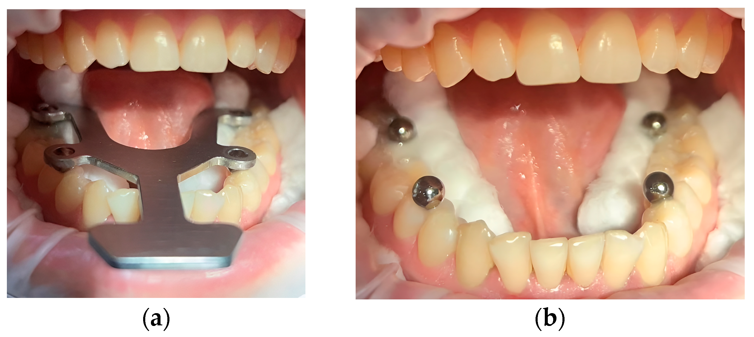 Diagnostics 15 02077 g005 Diagnostics 15 02077 g005