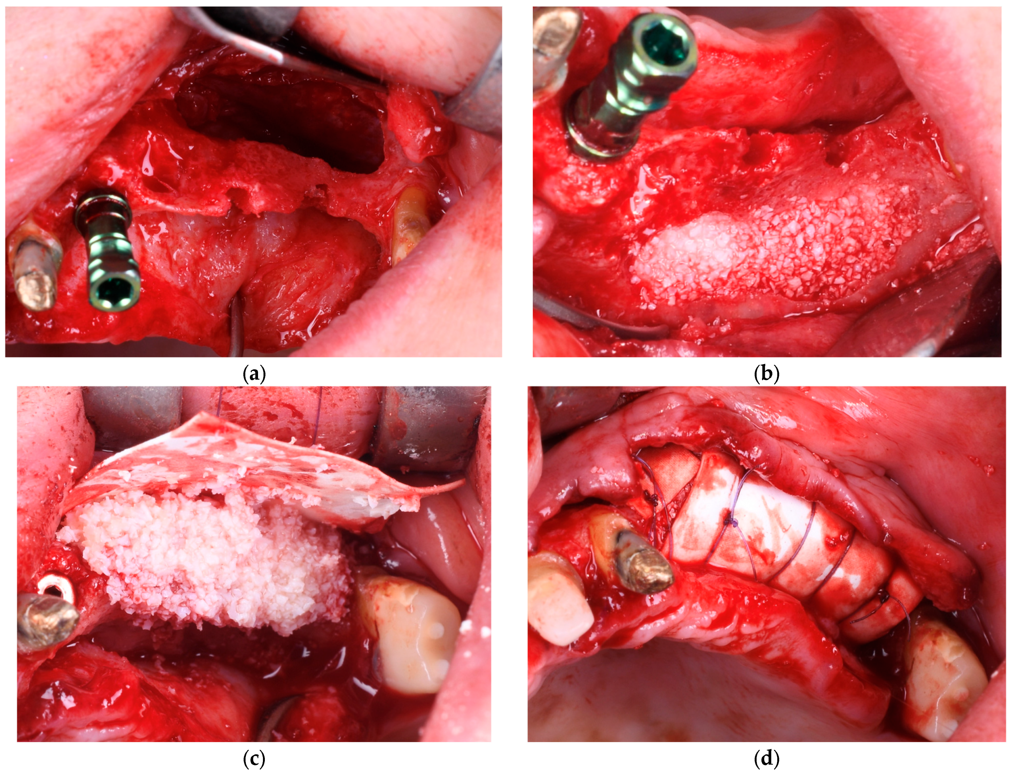 Diagnostics 15 02078 g003