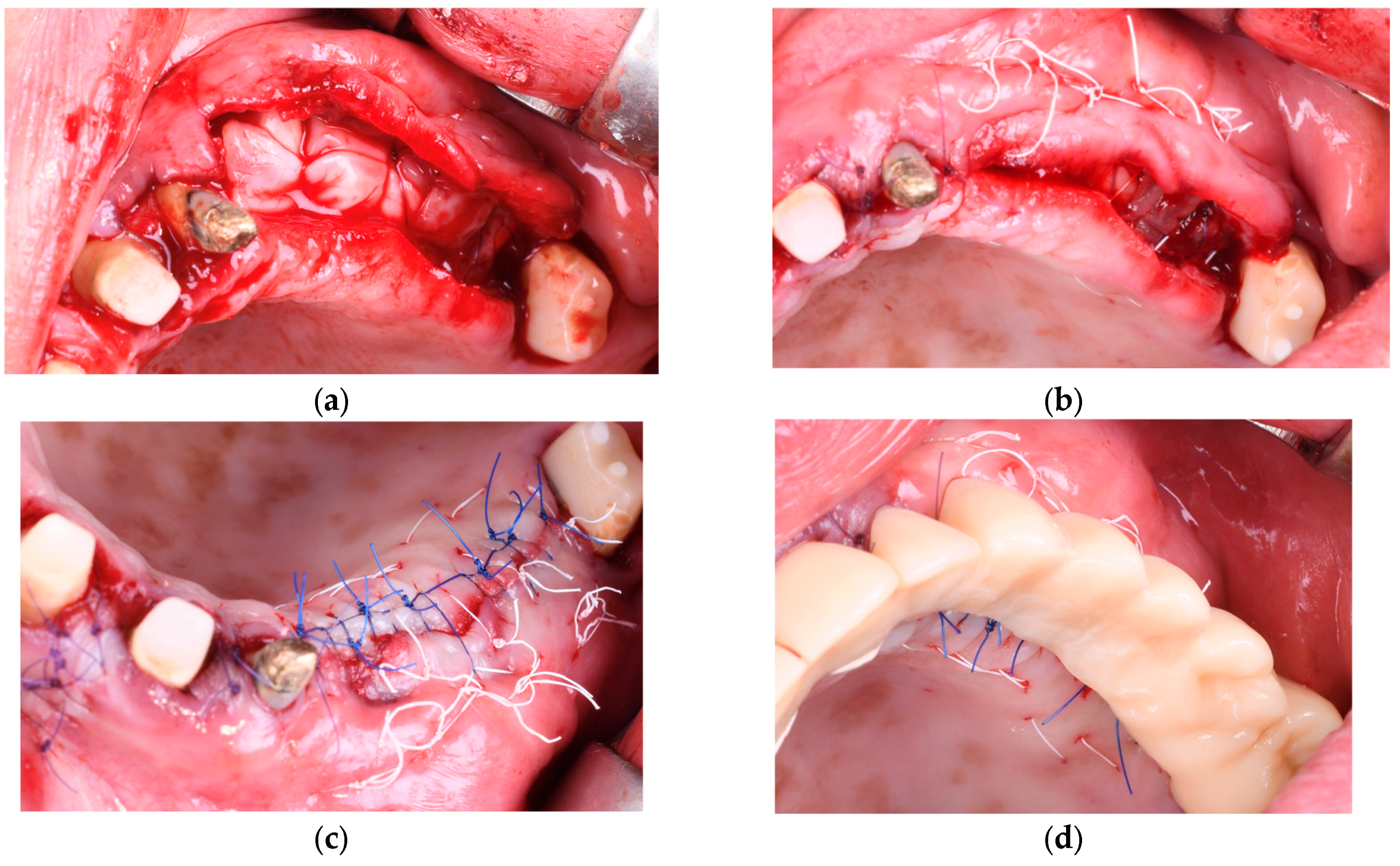 Diagnostics 15 02078 g004