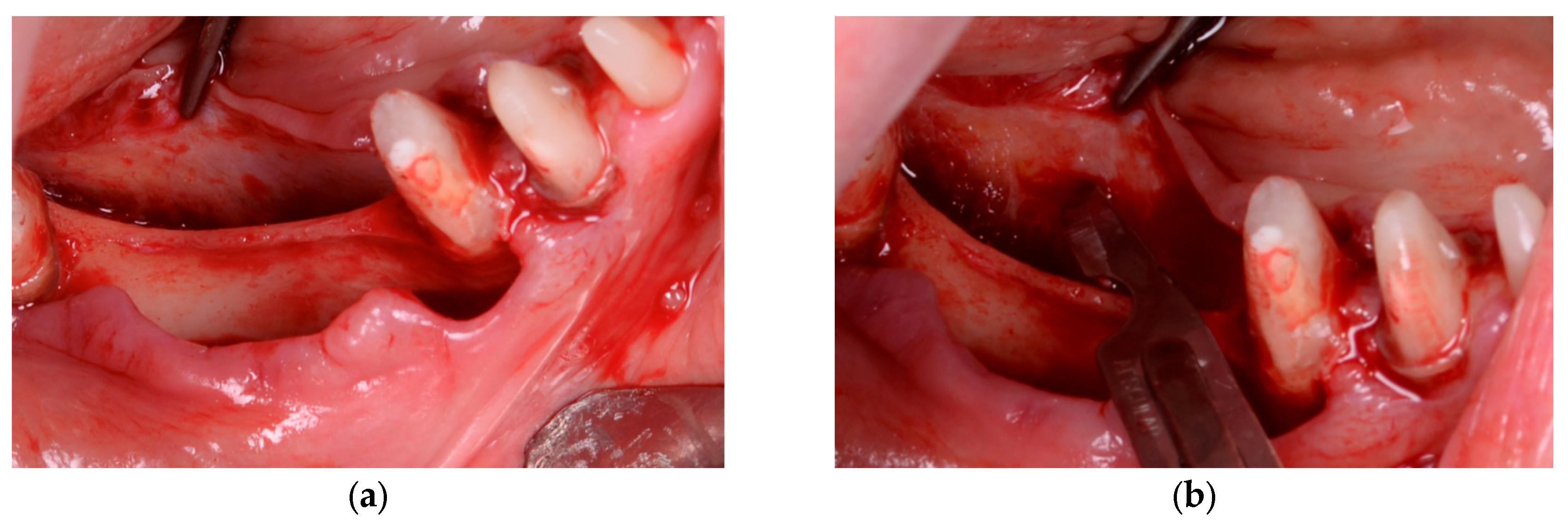 Diagnostics 15 02078 g005a