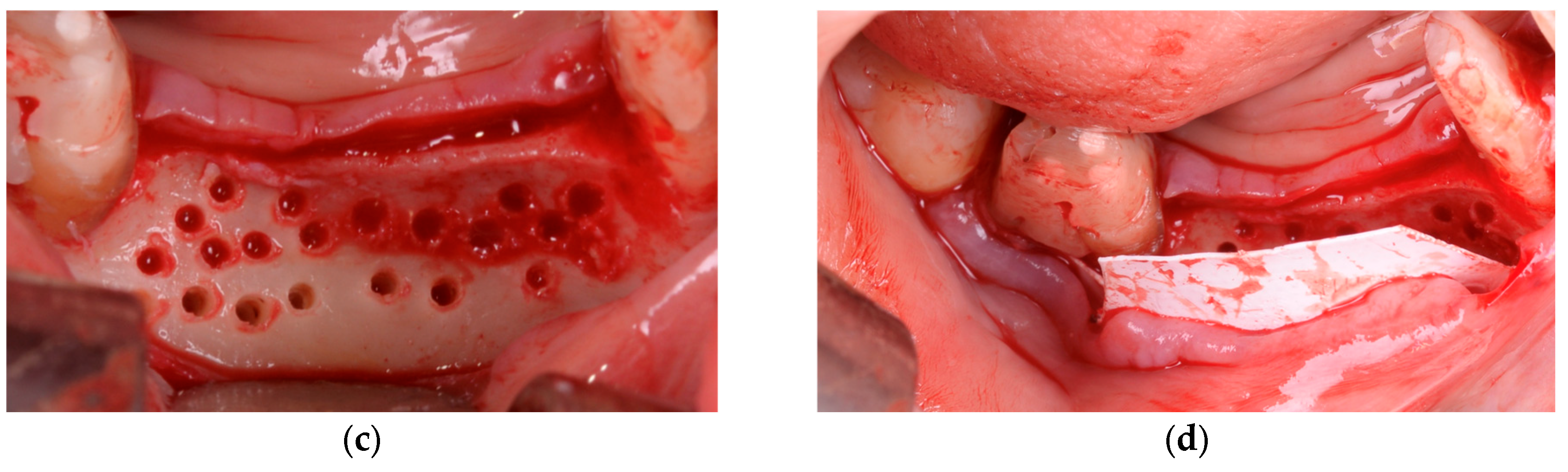 Diagnostics 15 02078 g005b