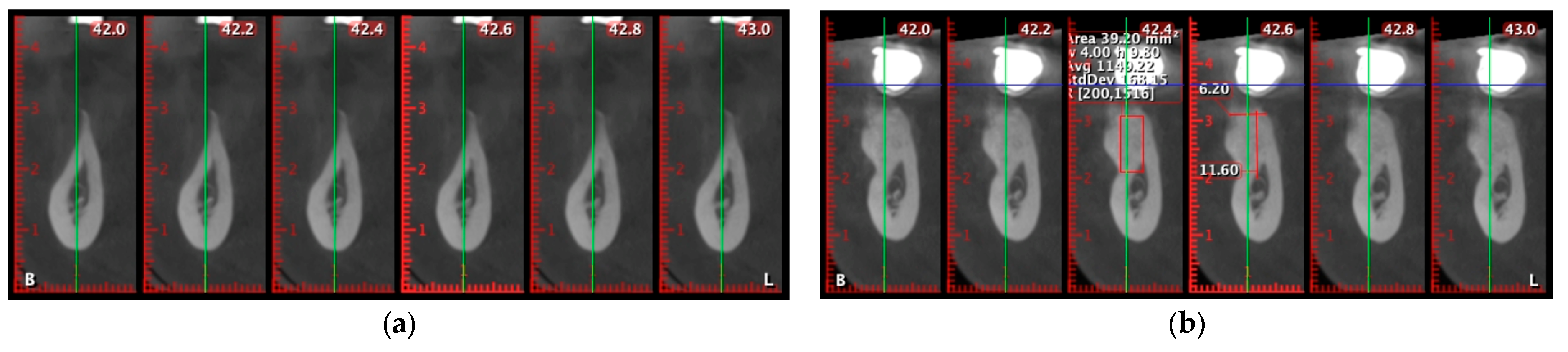 Diagnostics 15 02078 g012