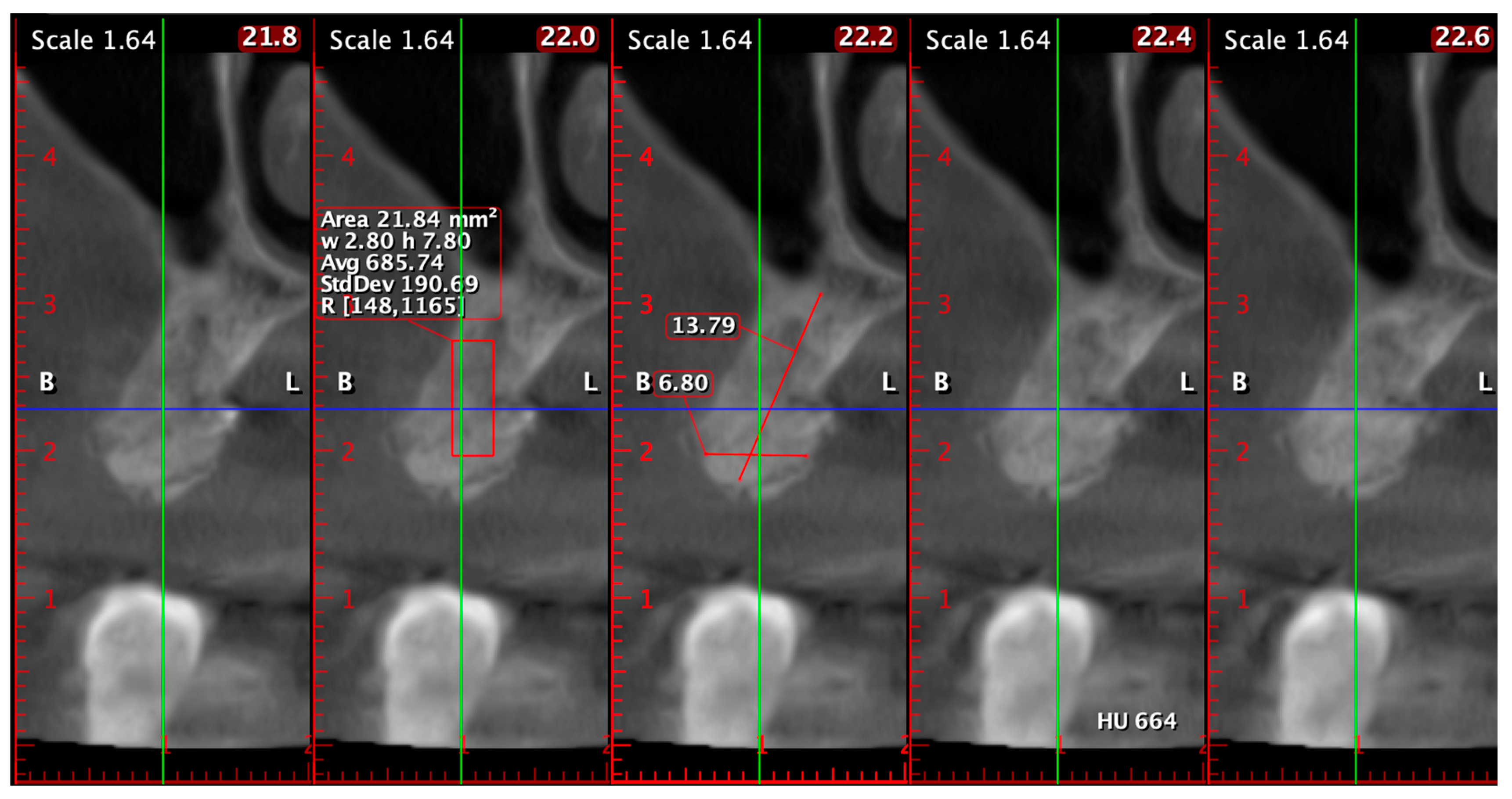 Diagnostics 15 02078 g014