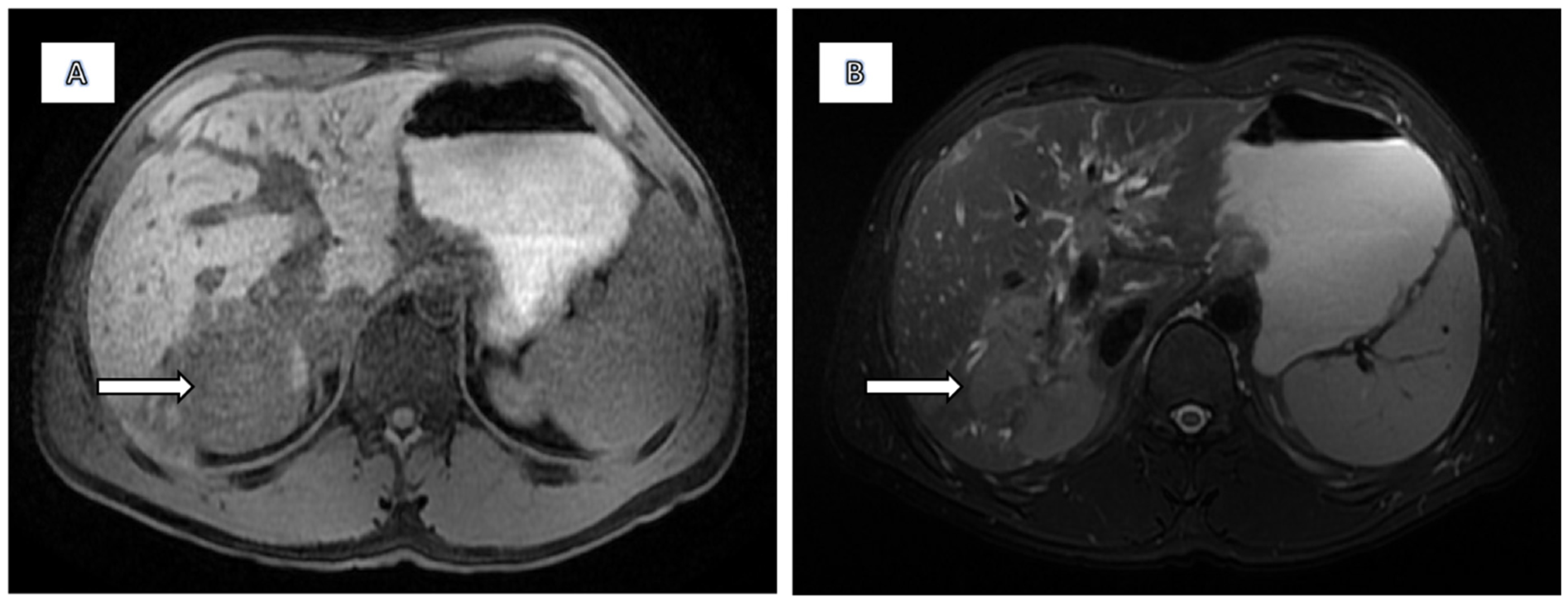 Diagnostics 15 02082 g001