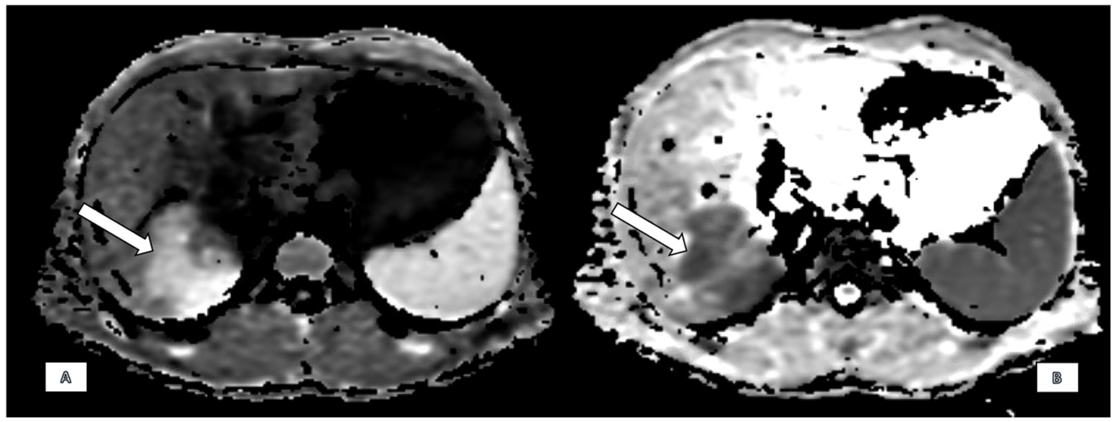 Diagnostics 15 02082 g002