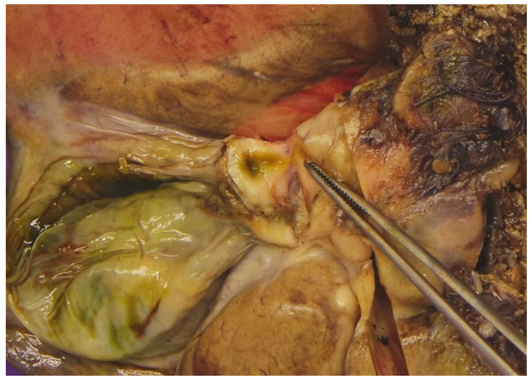 Diagnostics 15 02082 g005