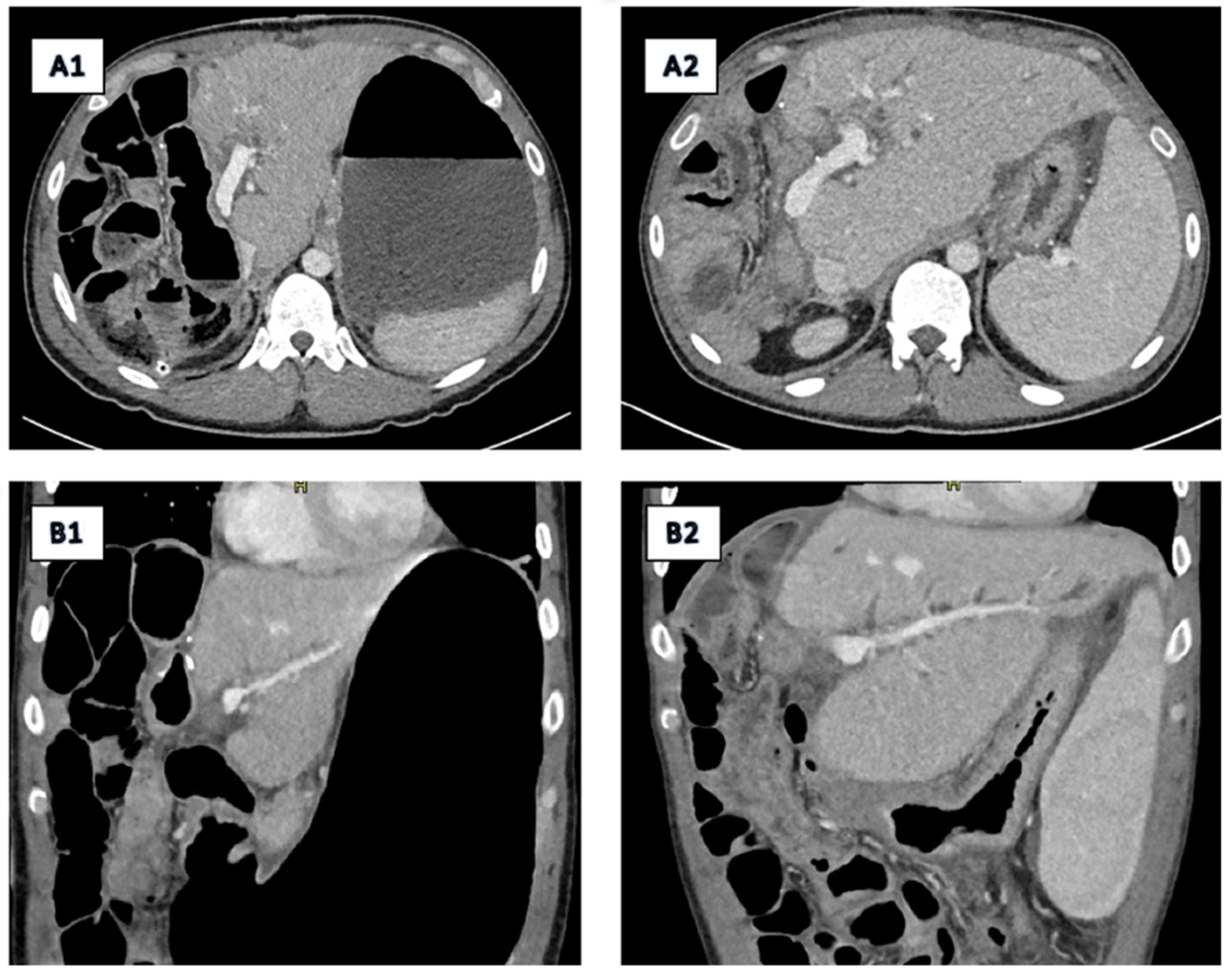 Diagnostics 15 02082 g008