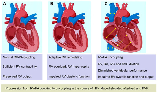 Clinical Usefulness of Right Ventricular–Pulmonary Artery Coupling in ...