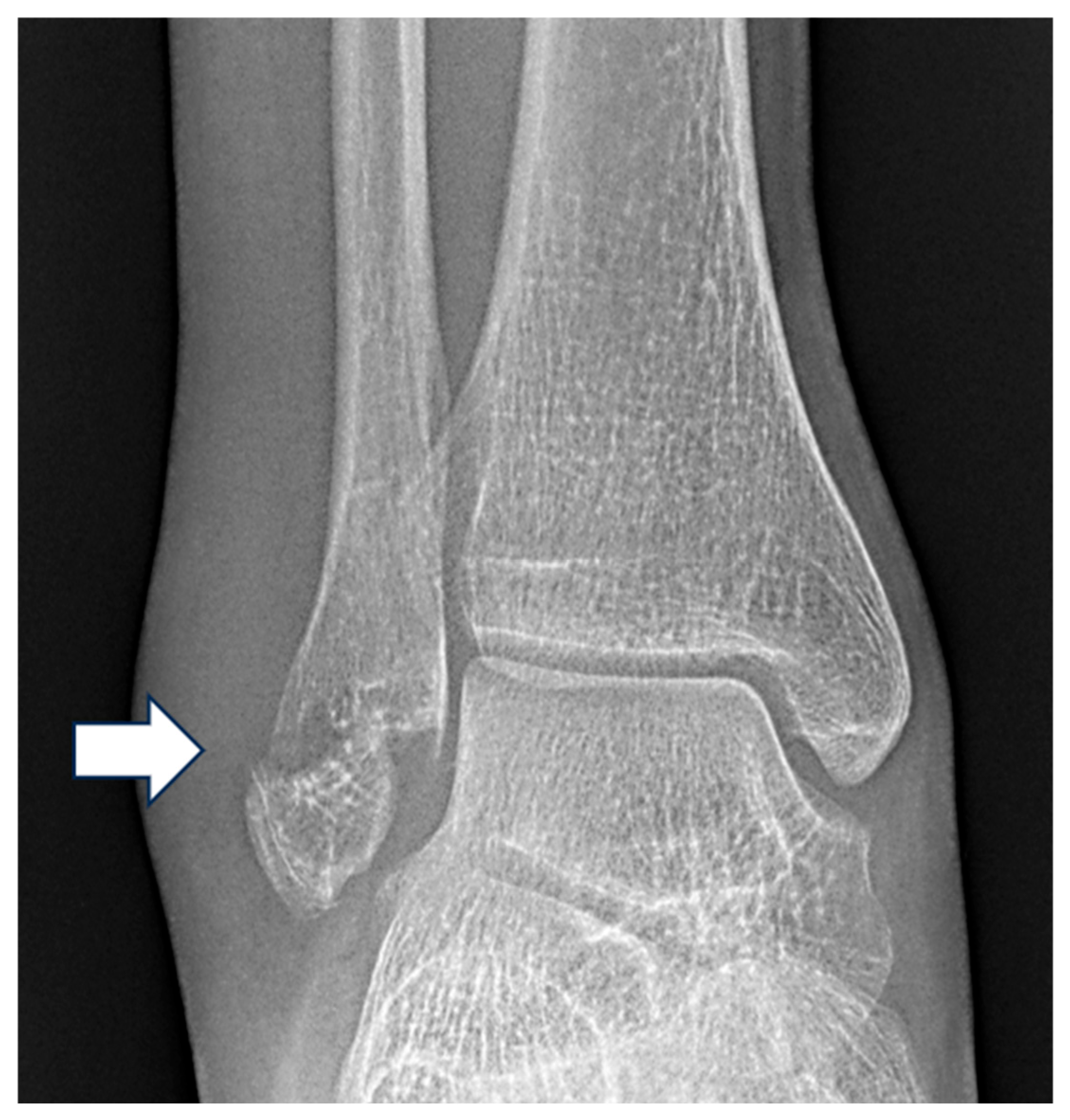 Diagnostics 15 02085 g001 Diagnostics 15 02085 g001