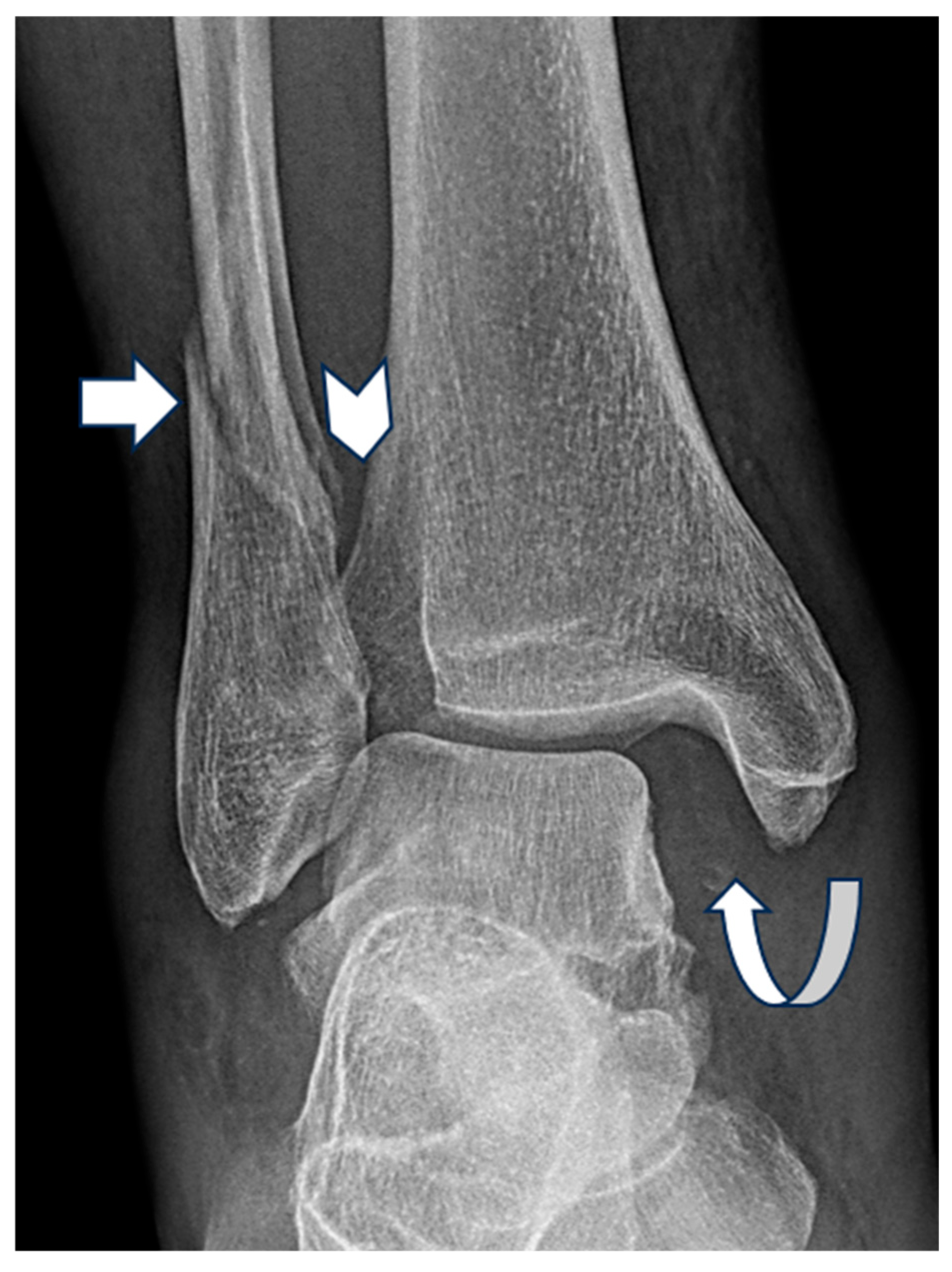 Diagnostics 15 02085 g003 Diagnostics 15 02085 g003