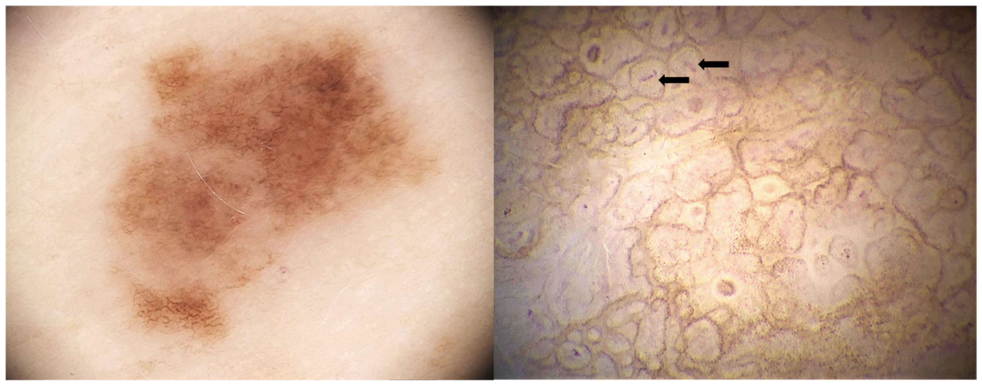 Diagnostics 15 02100 g004 Diagnostics 15 02100 g004