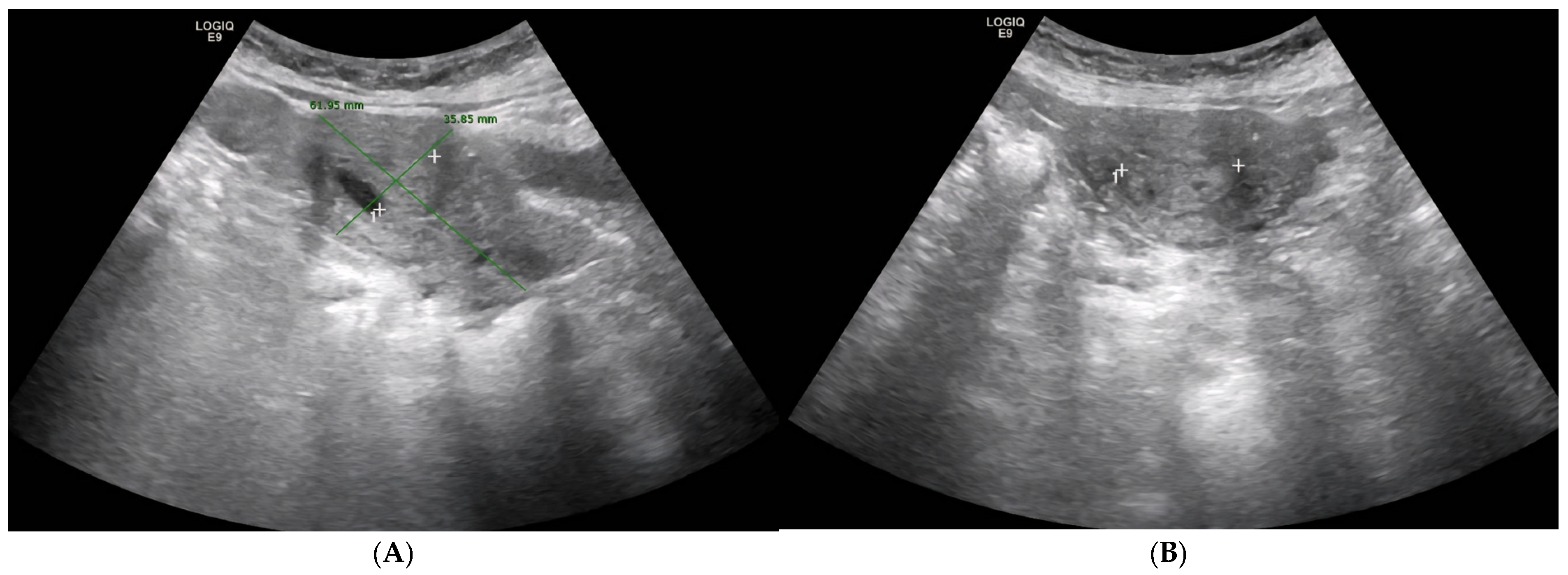 Diagnostics 15 02164 g001