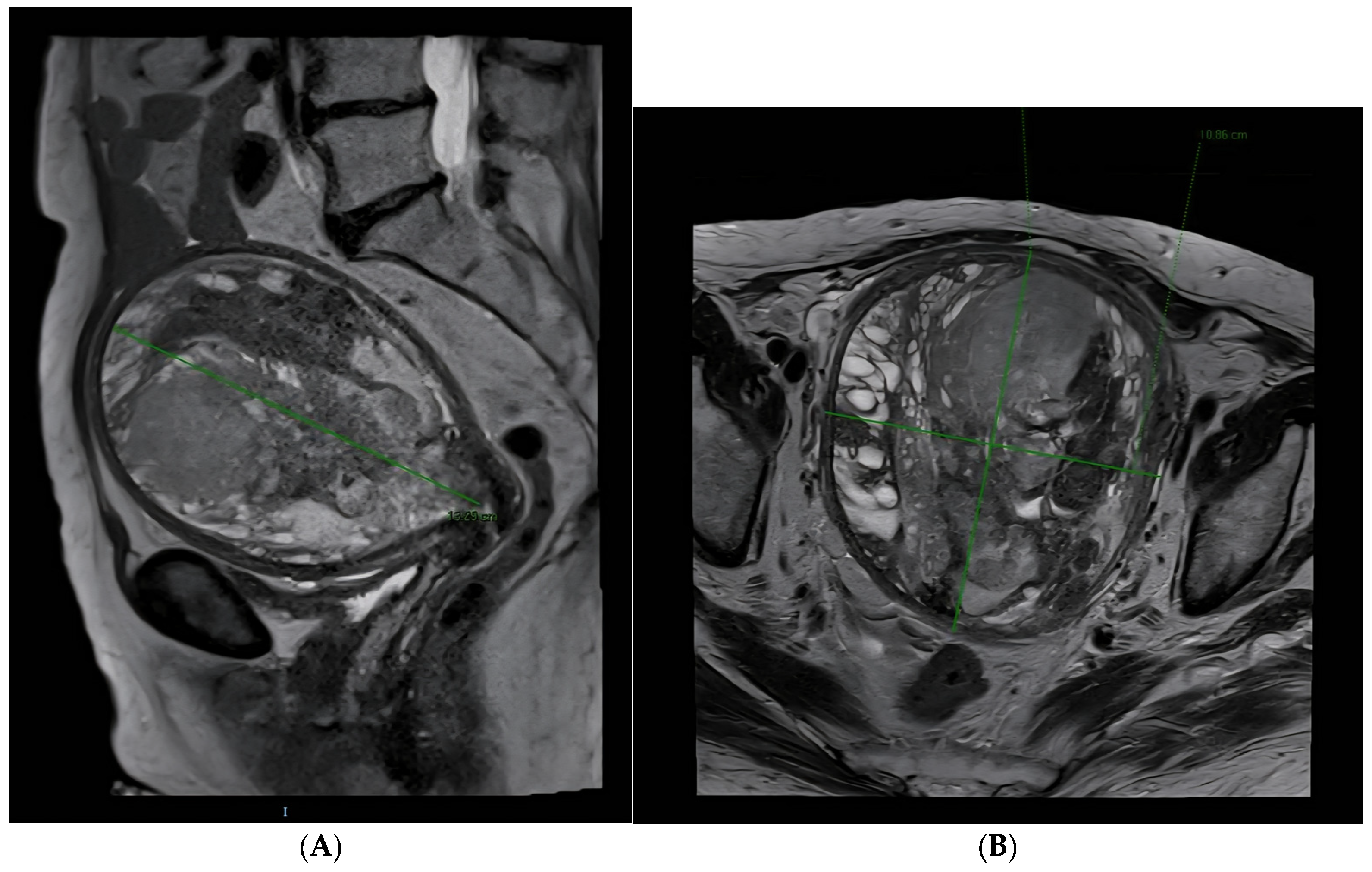 Diagnostics 15 02164 g007