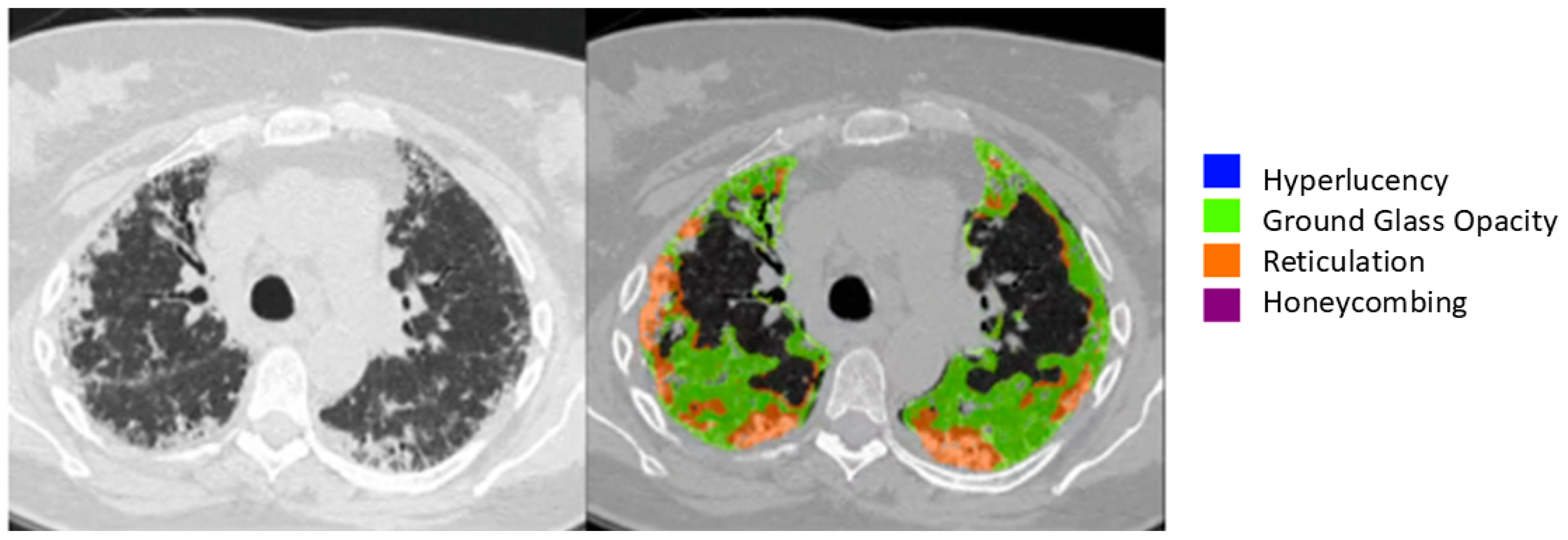 Diagnostics 15 02179 g002 Diagnostics 15 02179 g002