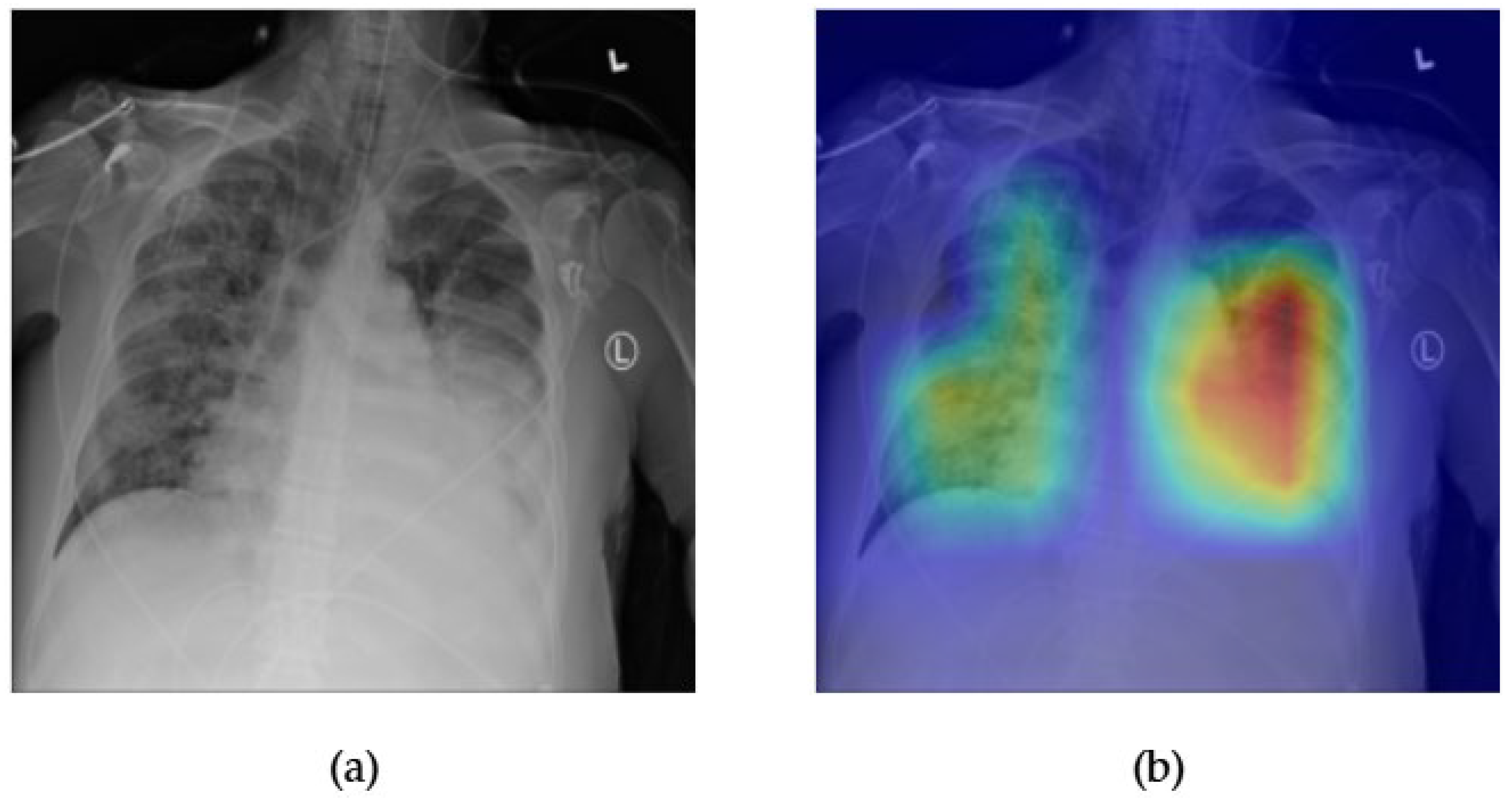 Diagnostics 15 02215 g005