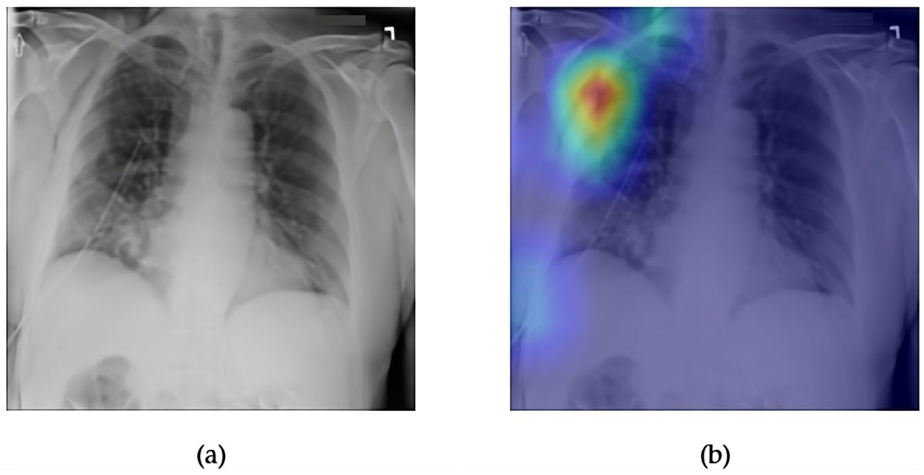 Diagnostics 15 02215 g011