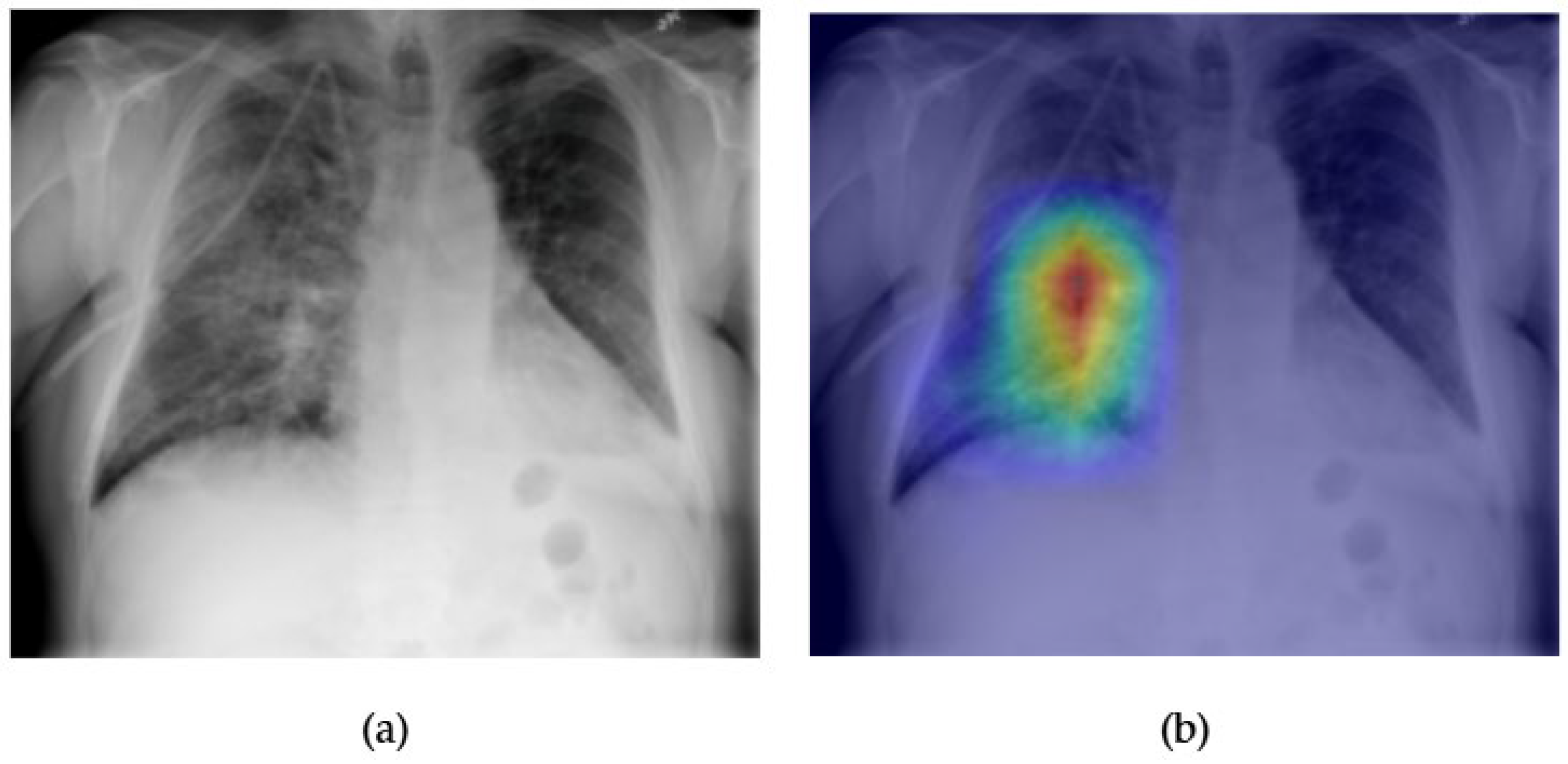 Diagnostics 15 02215 g017