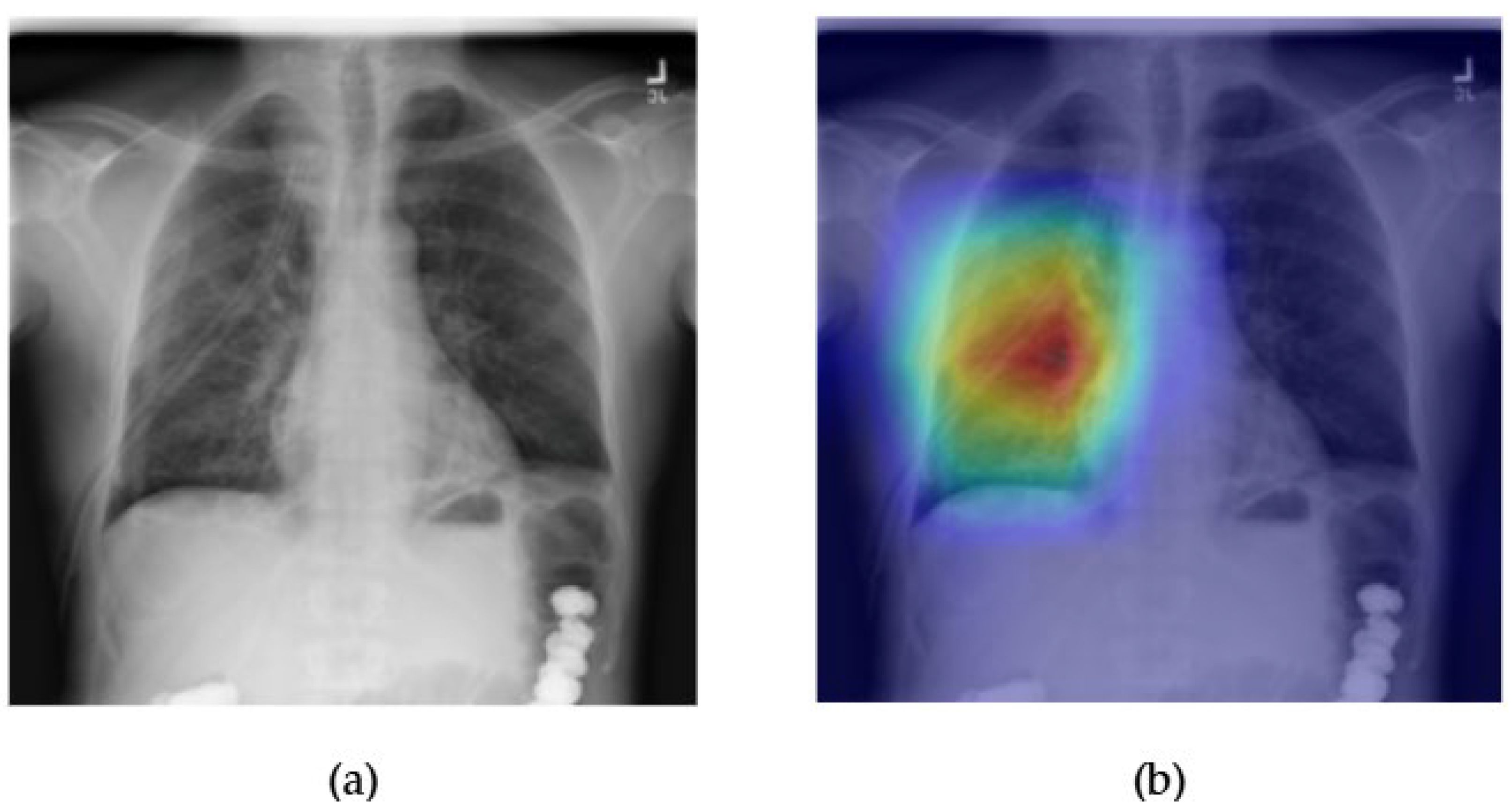 Diagnostics 15 02215 g021
